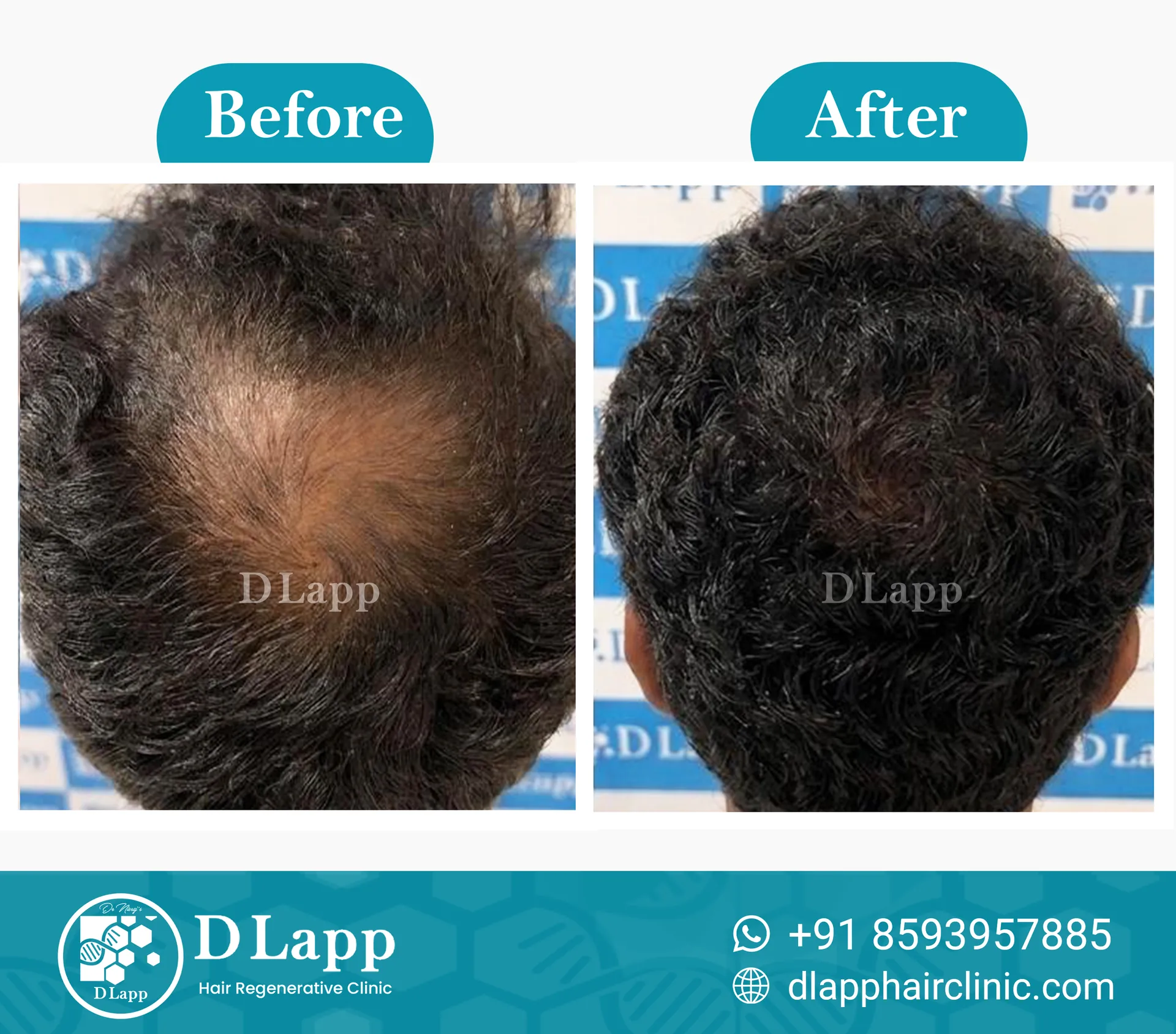 Before/After Medical Image