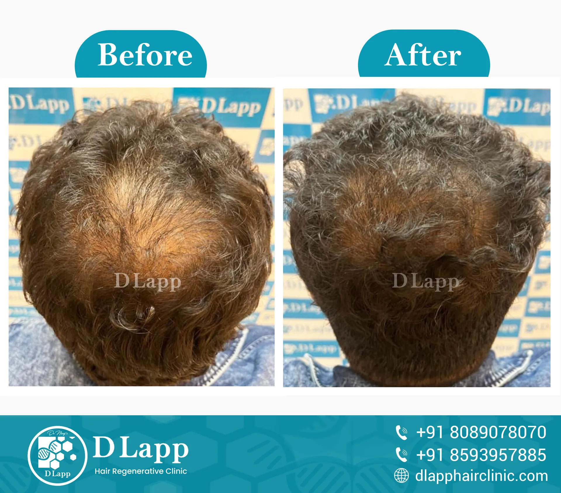 Before/After Medical Image