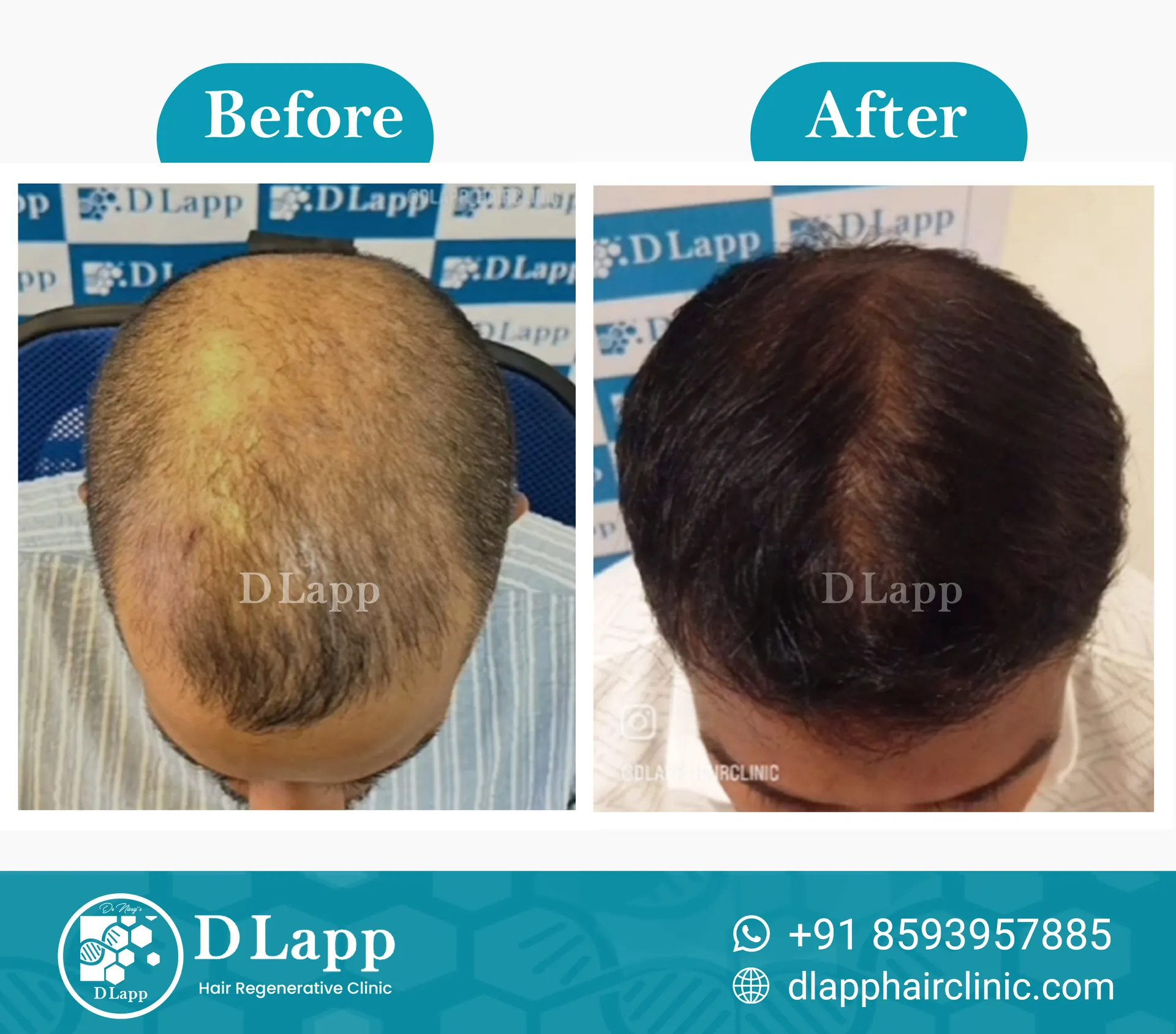 Hair Stem Cell Activation