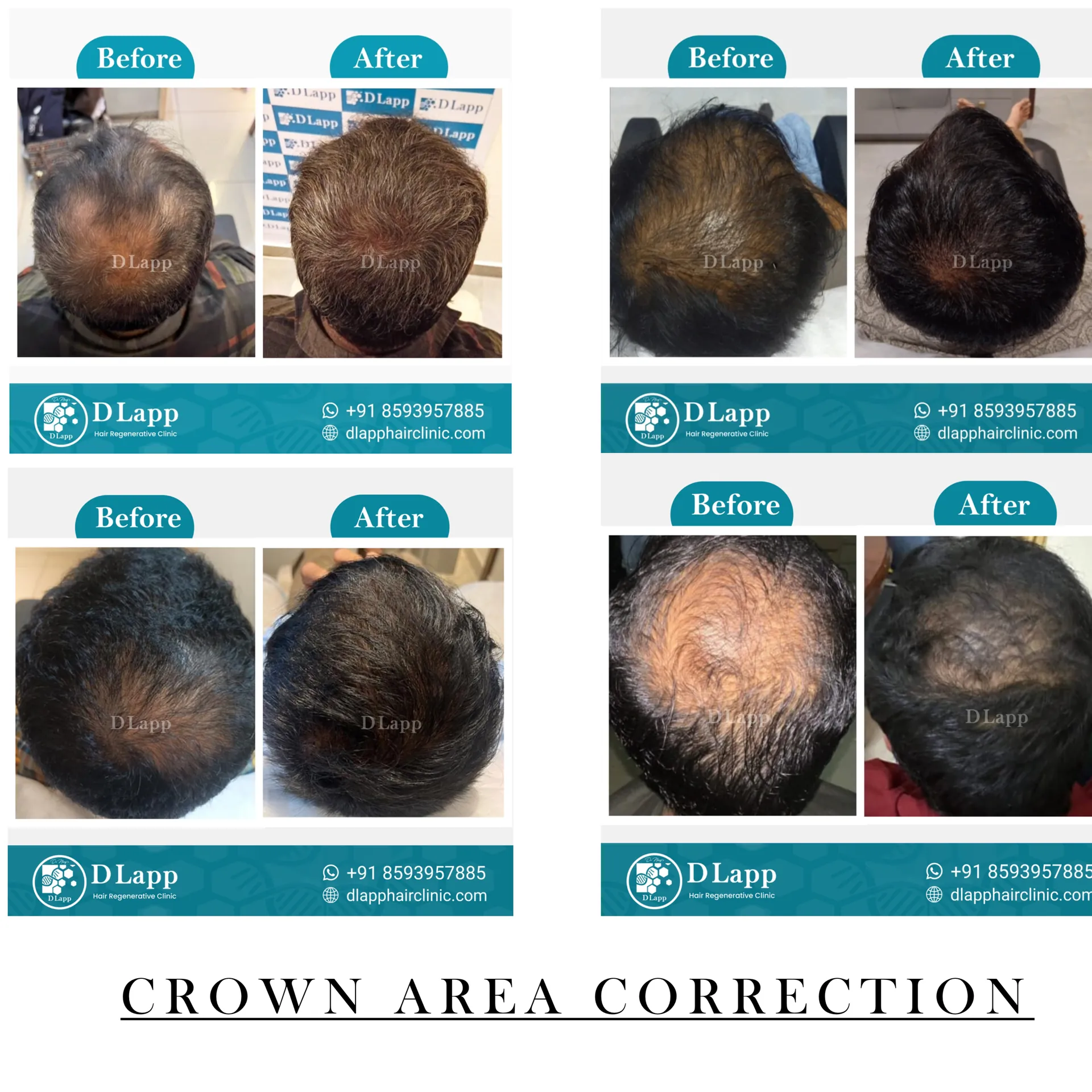 Hair Stem Cell Activation