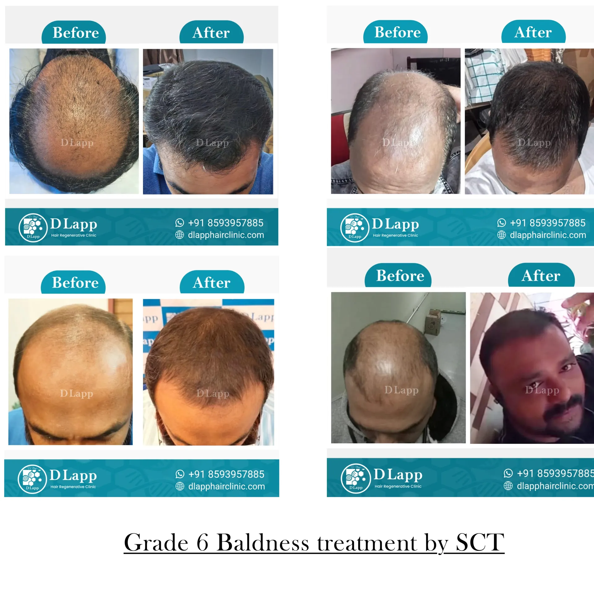 Hair Stem Cell Activation