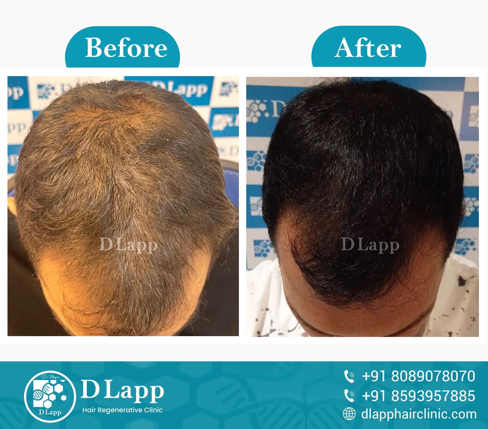 Before/After Medical Image
