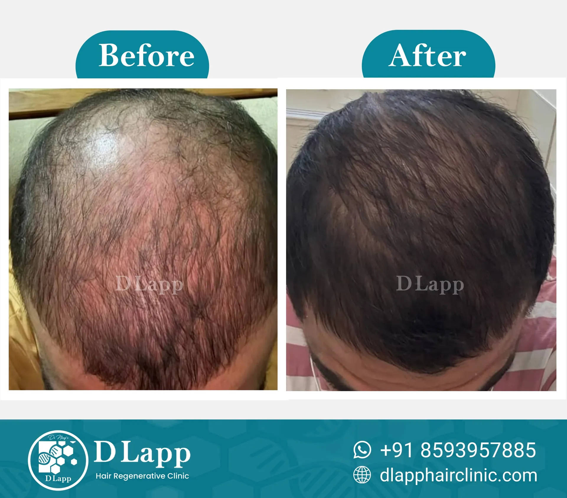 Before/After Medical Image