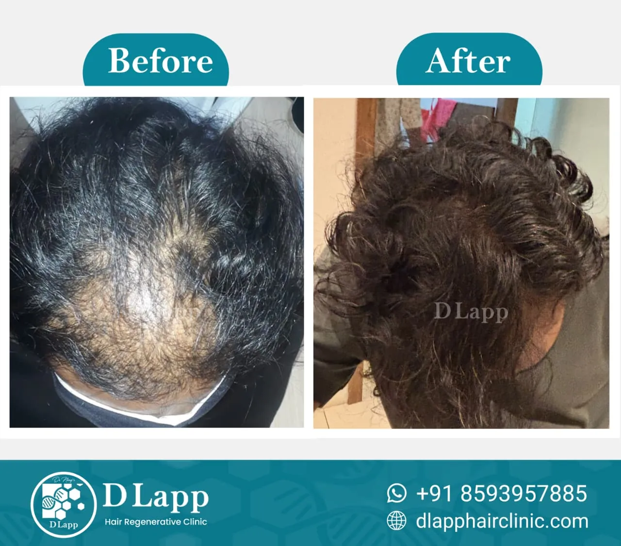 Hair Stem Cell Activation