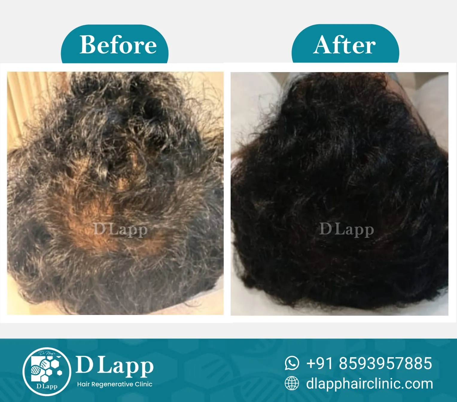 Before/After Medical Image
