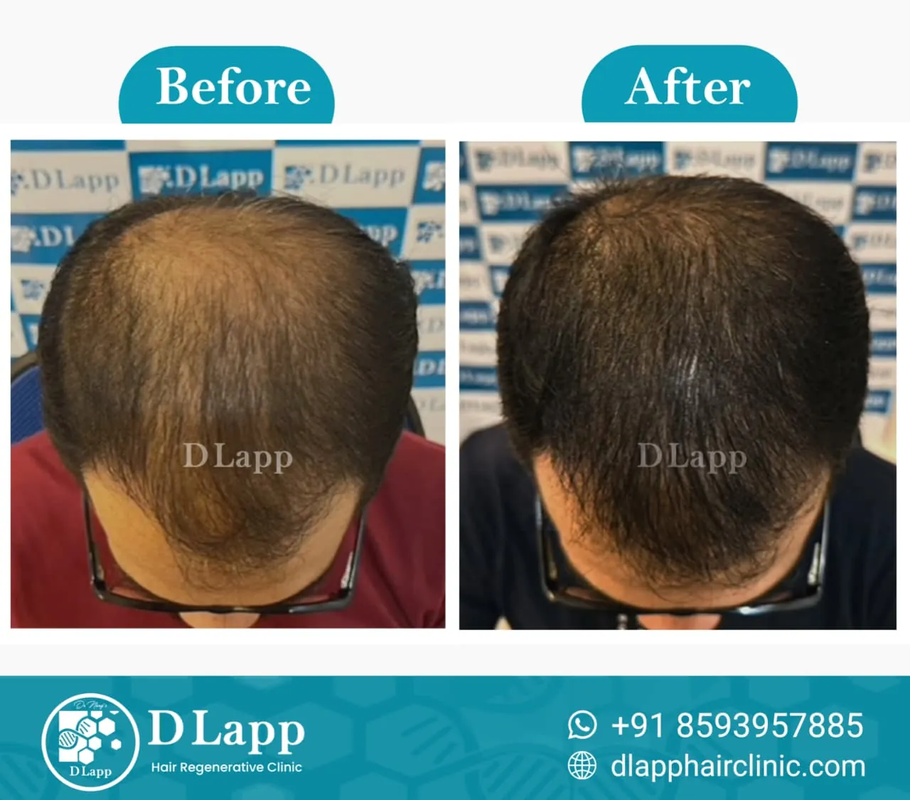 Before/After Medical Image