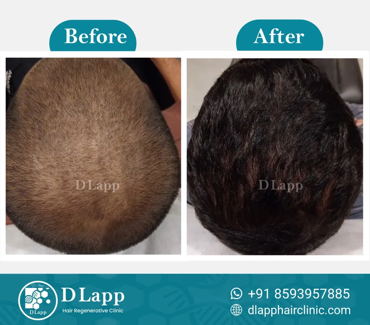 Before/After Medical Image
