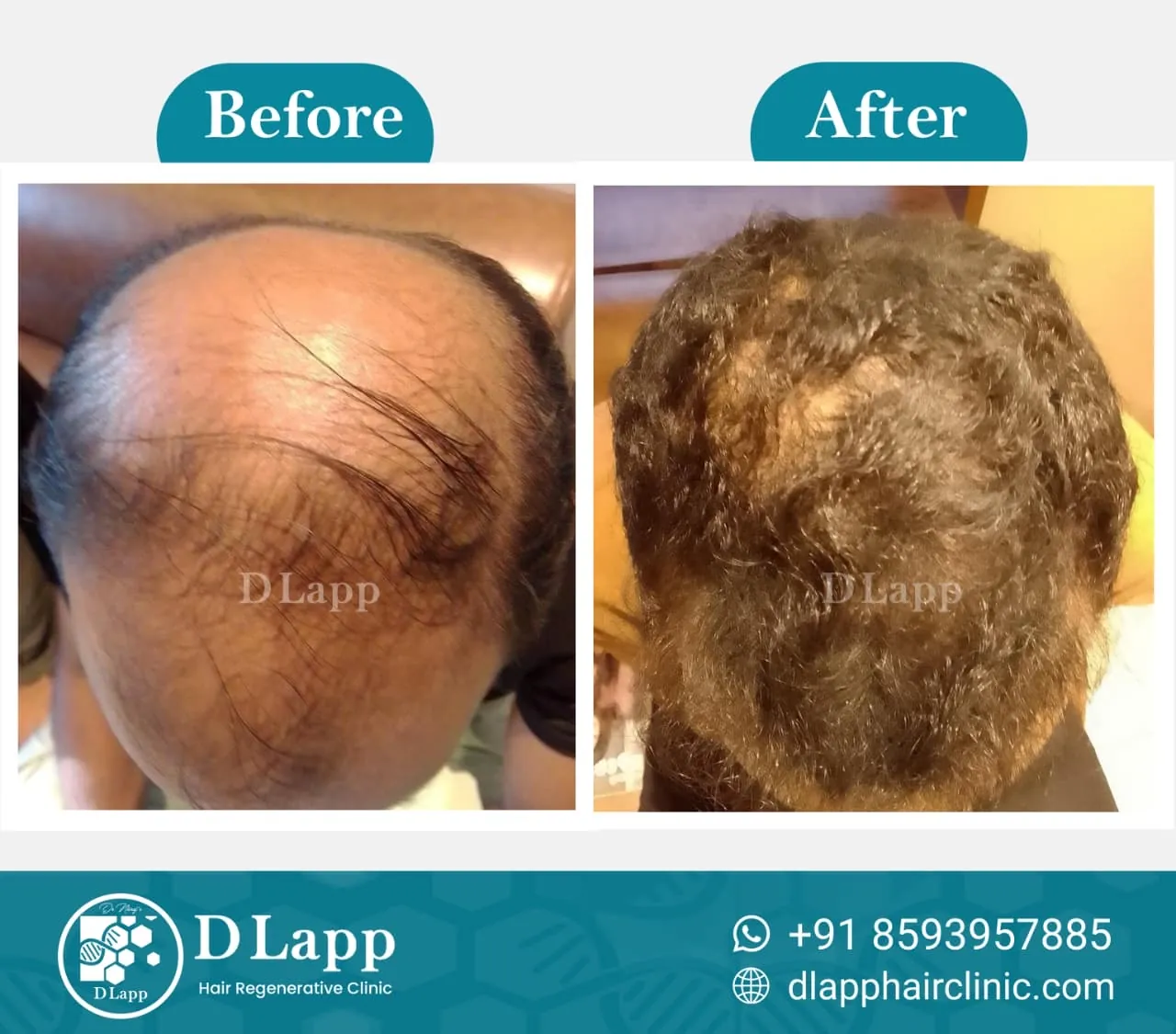 Before/After Medical Image