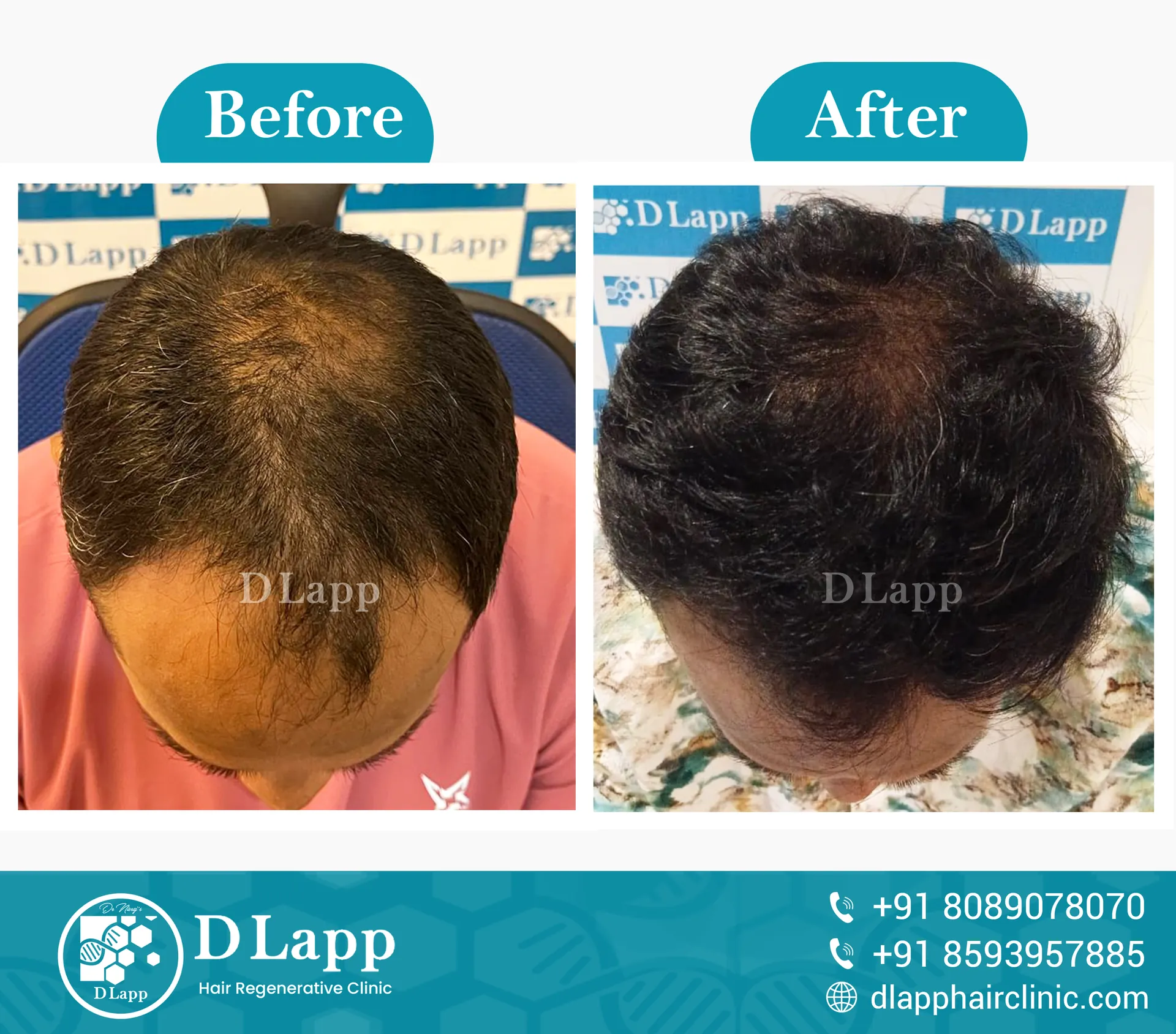 Before/After Medical Image