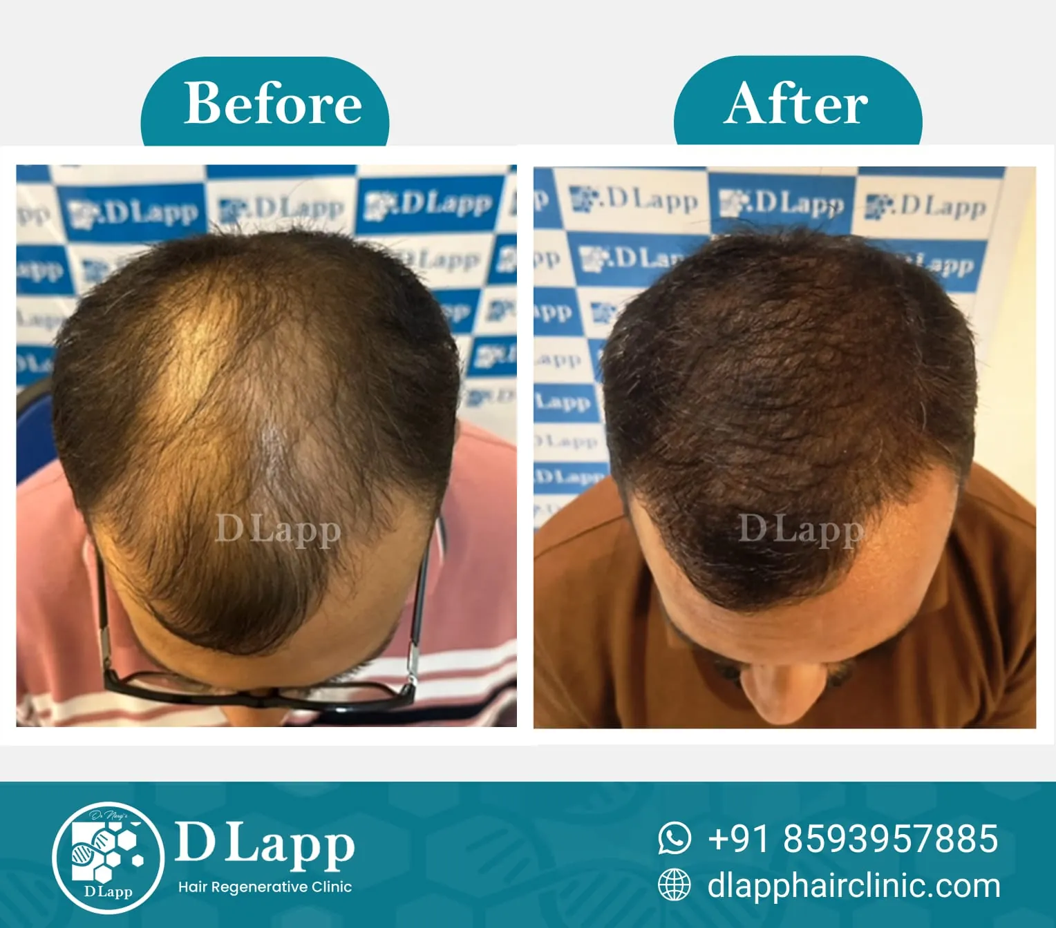 Before/After Medical Image