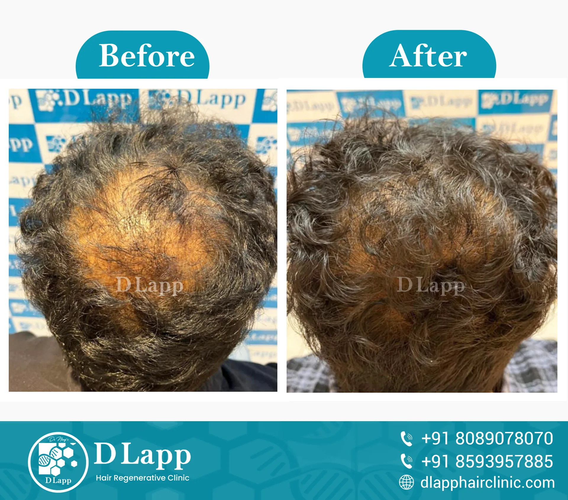 Before/After Medical Image