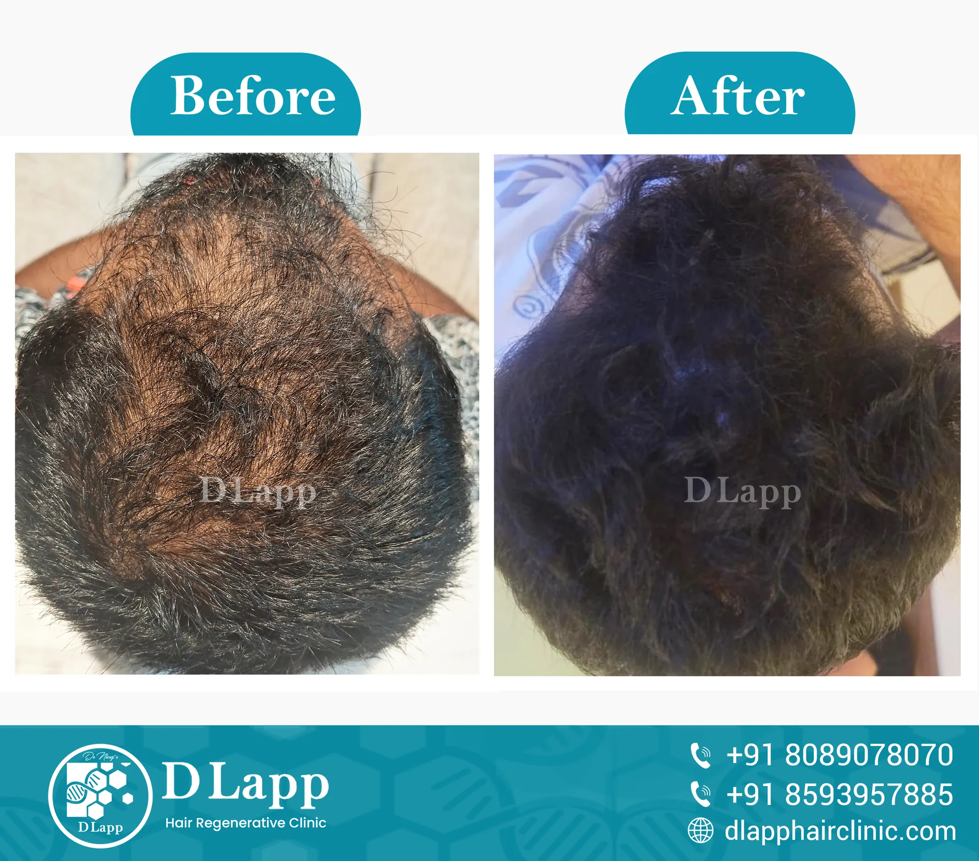 Before/After Medical Image