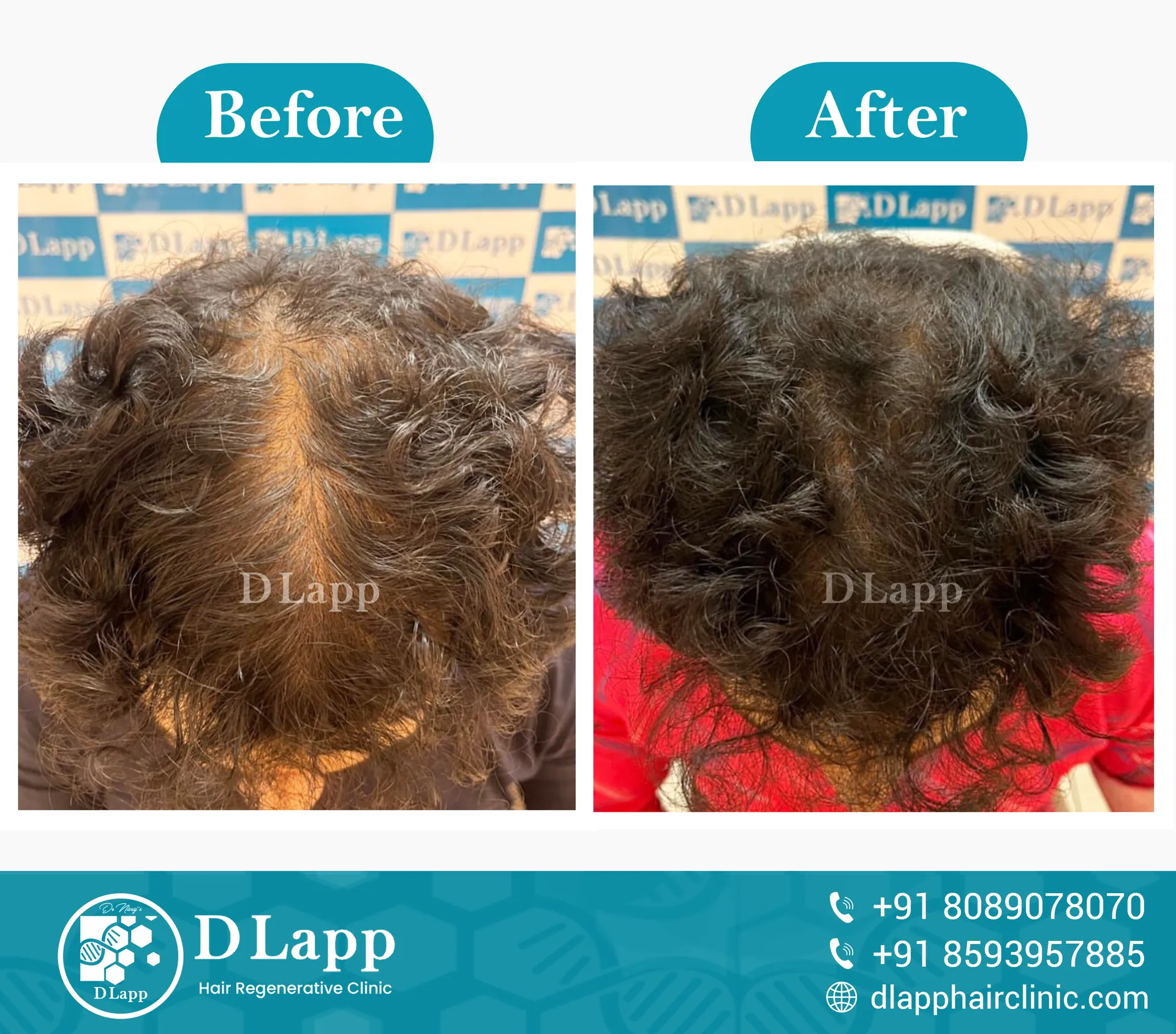 Before/After Medical Image