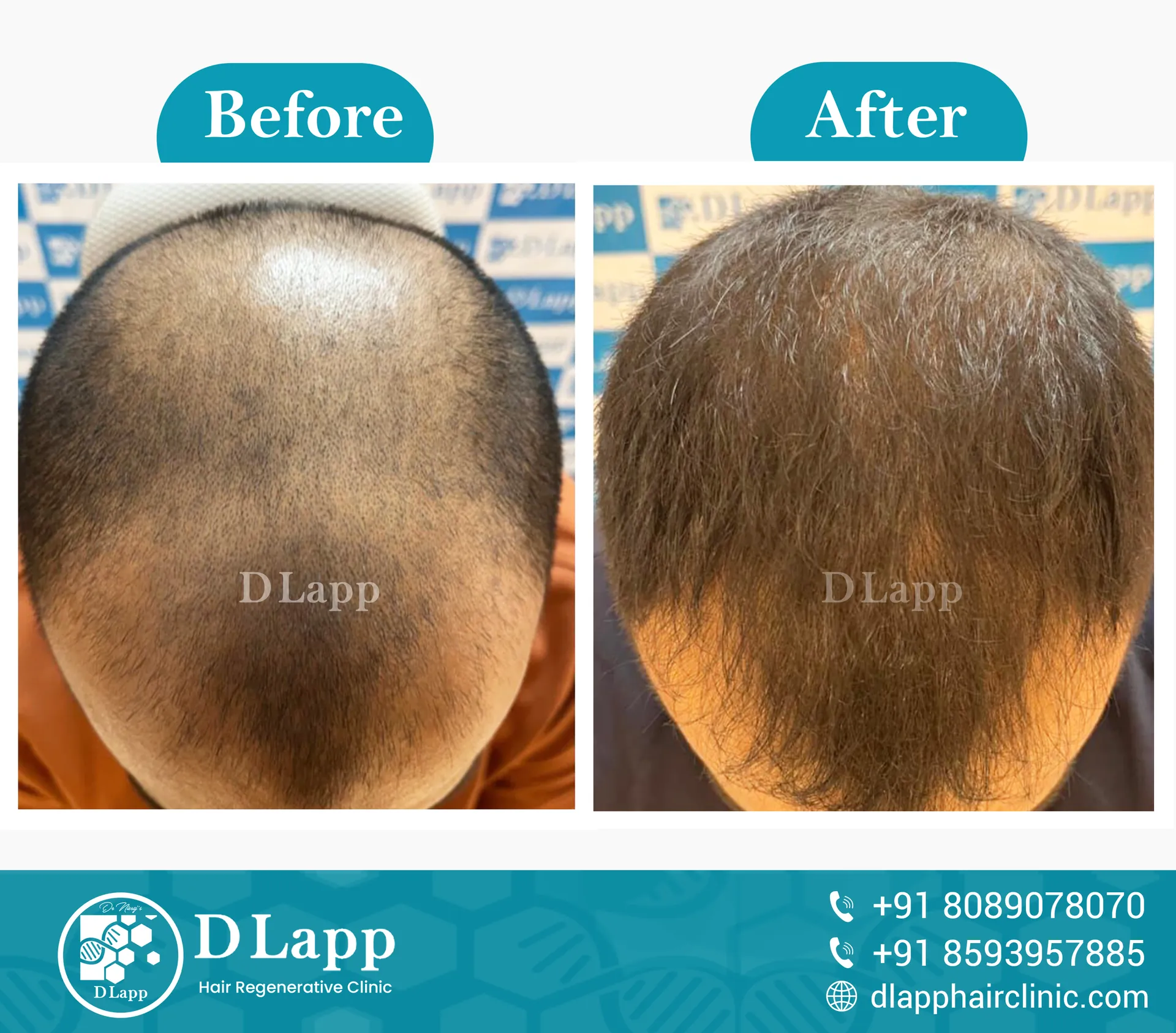Before/After Medical Image