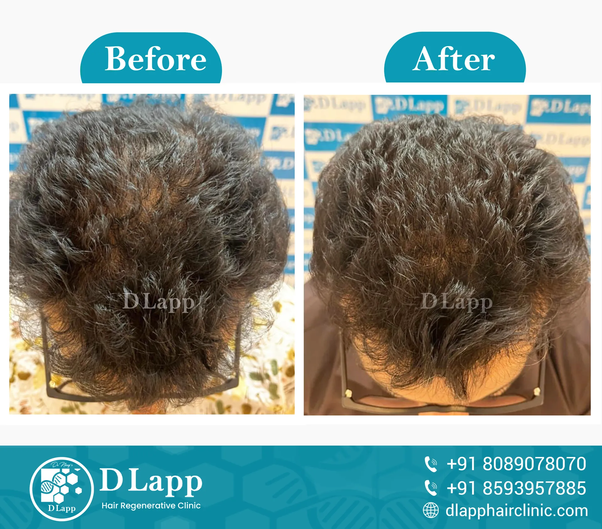 Before/After Medical Image