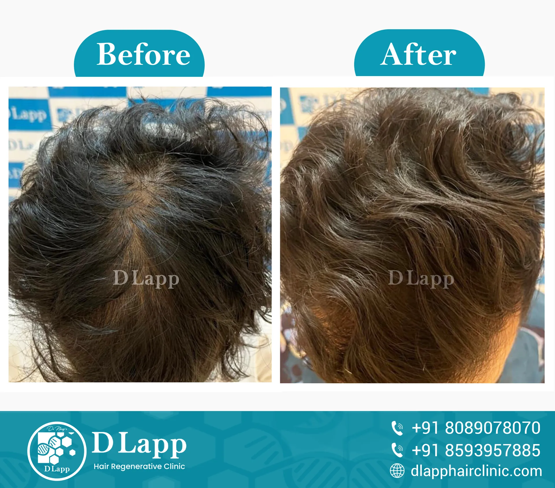 Before/After Medical Image