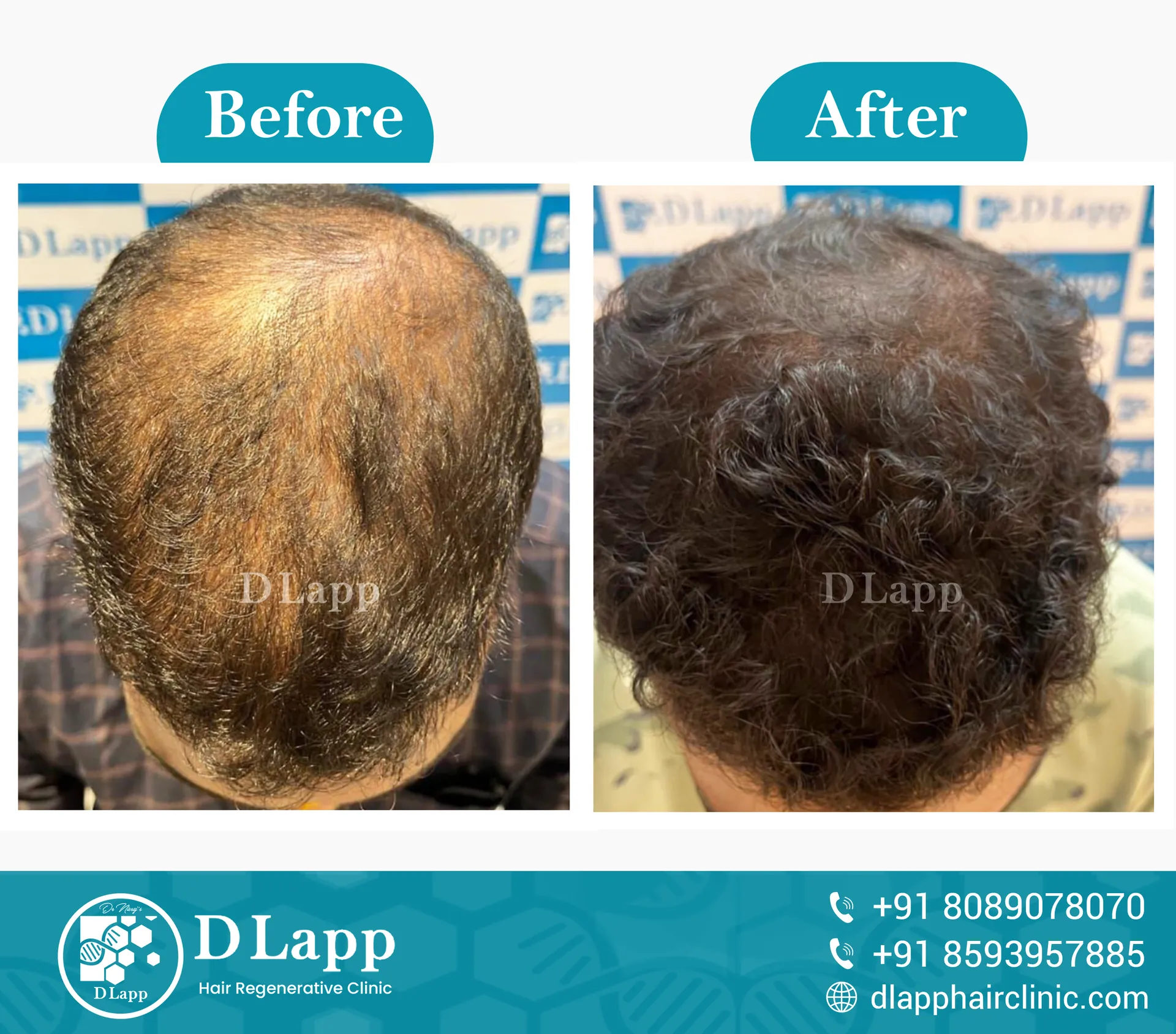 Before/After Medical Image