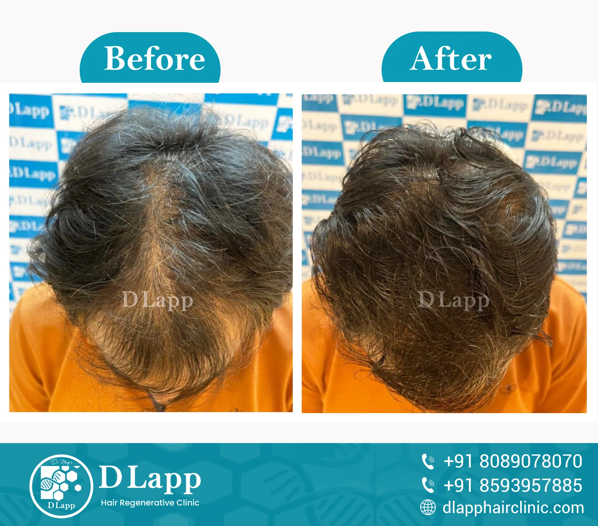 Before/After Medical Image