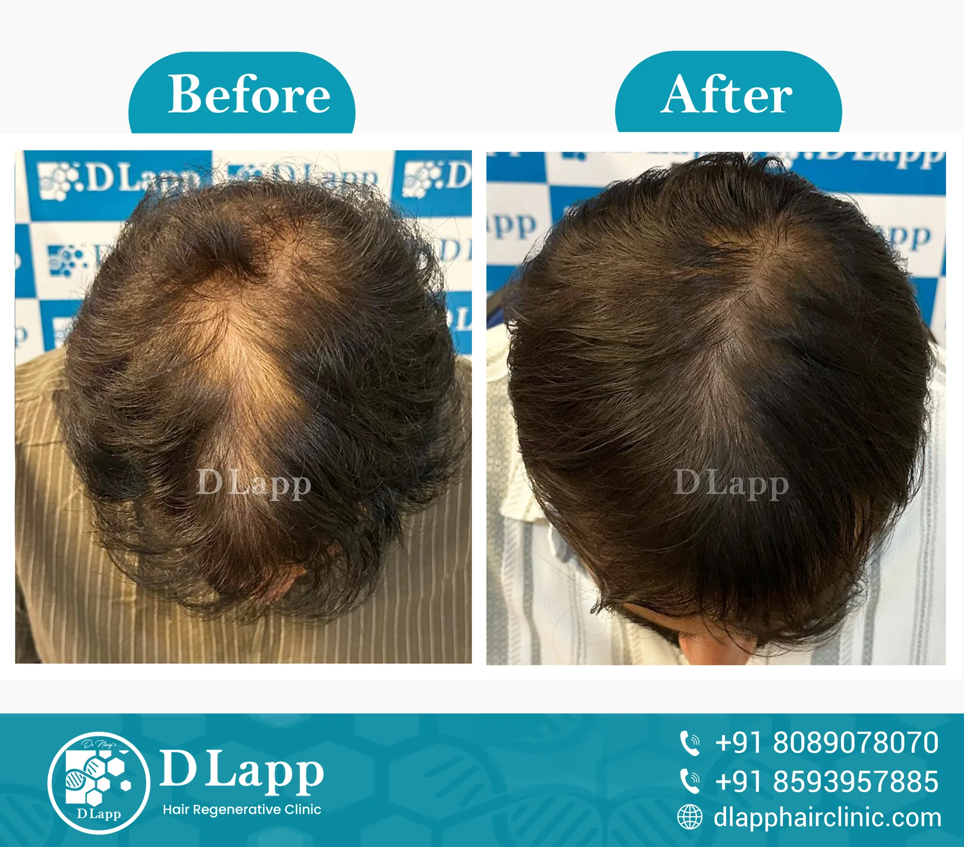 Before/After Medical Image
