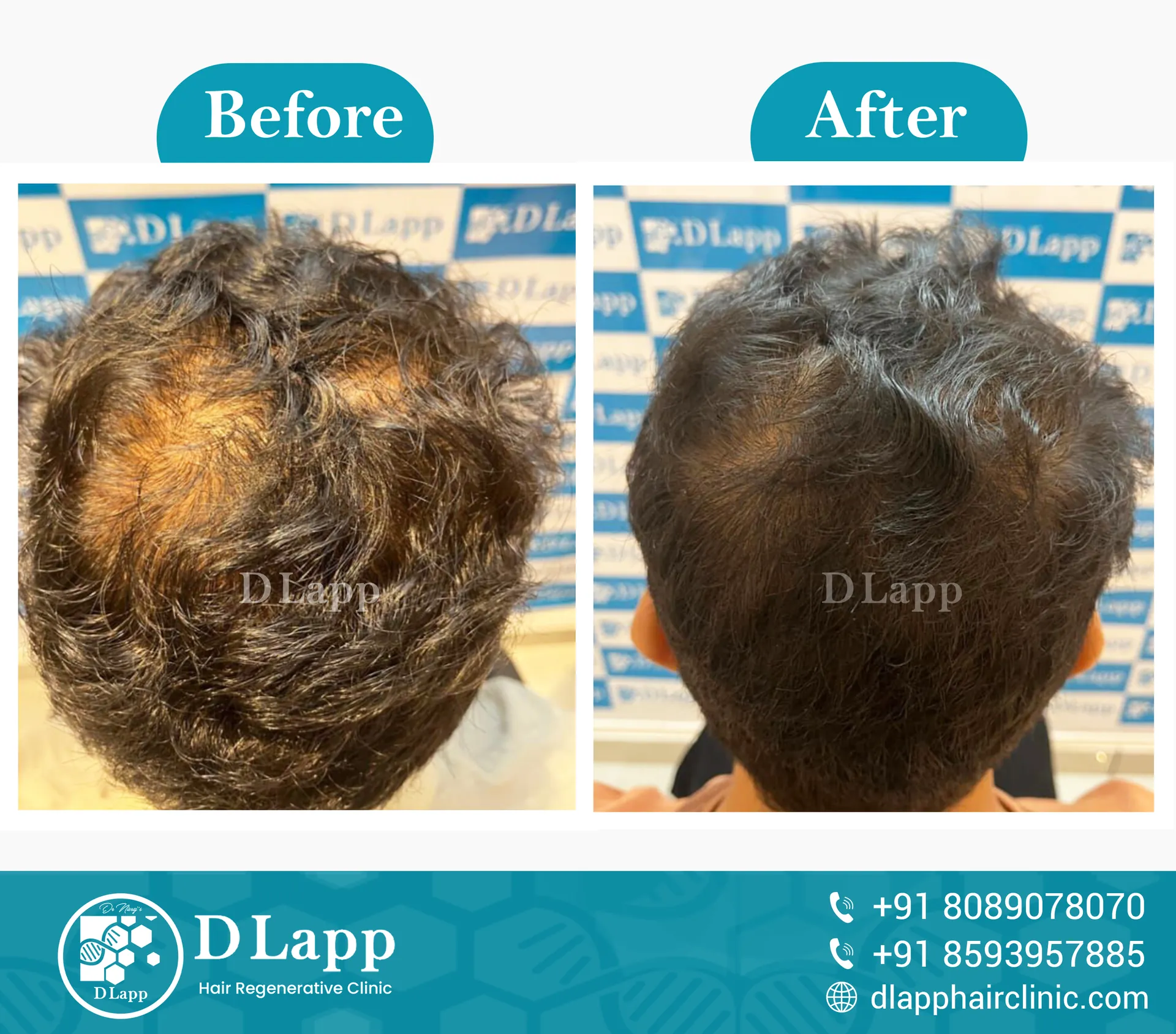 Before/After Medical Image