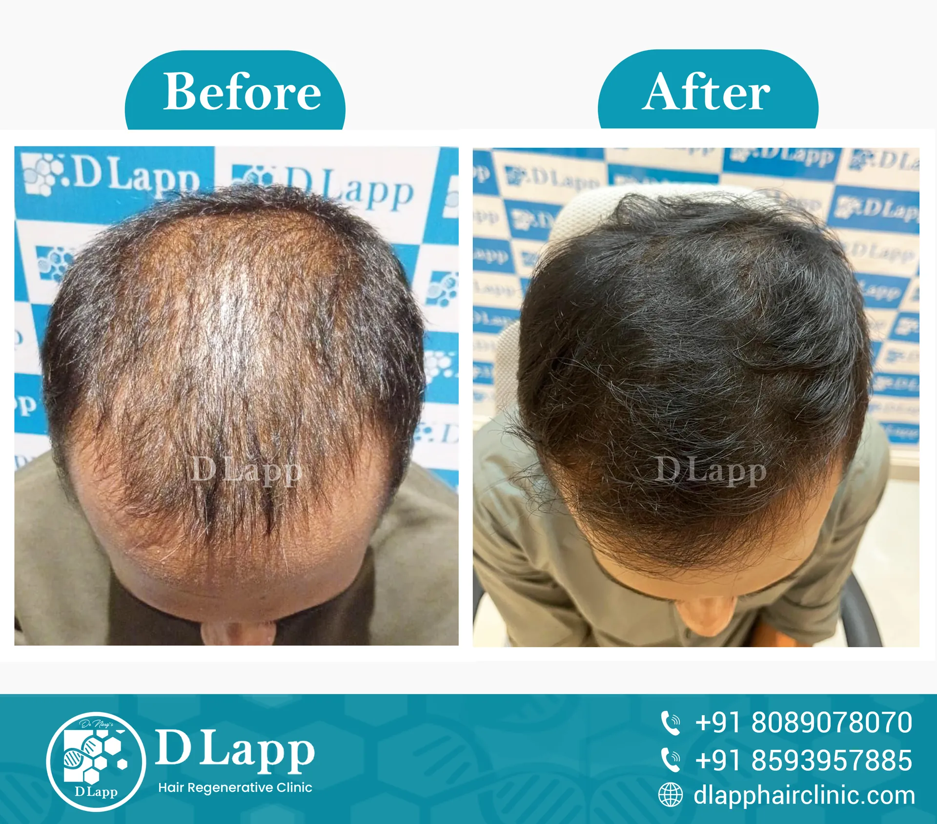 Before/After Medical Image