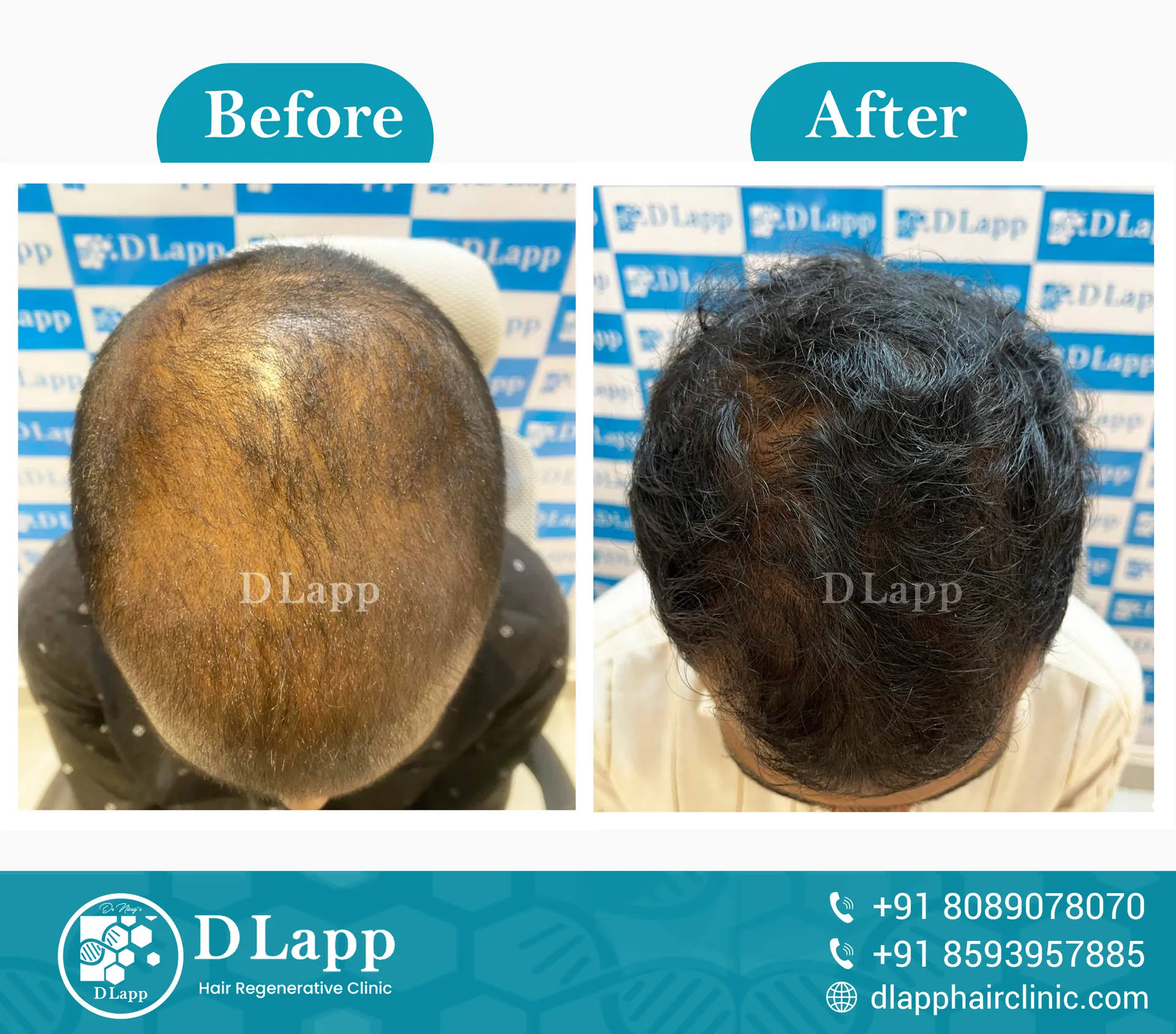 Before/After Medical Image