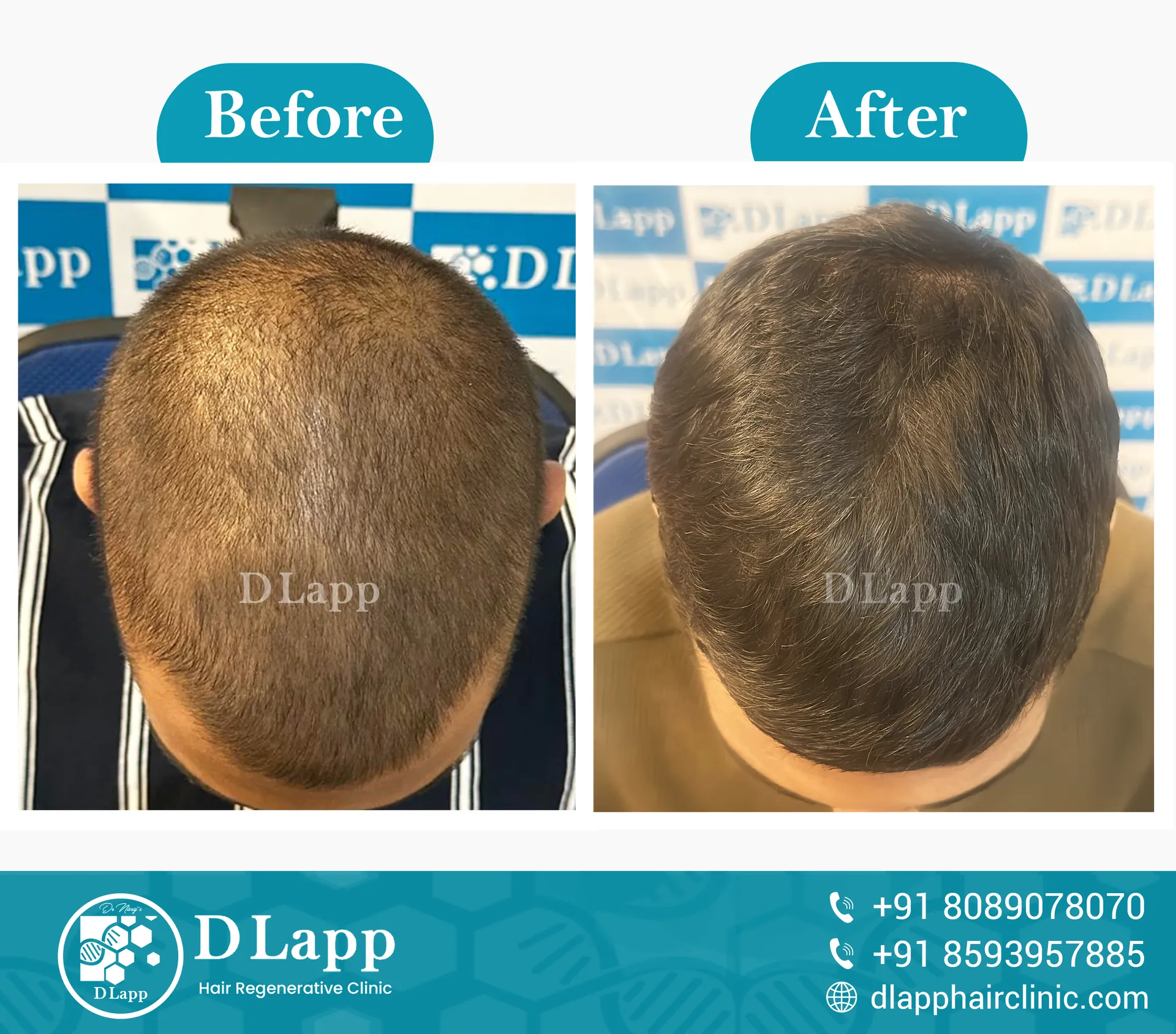 Before/After Medical Image