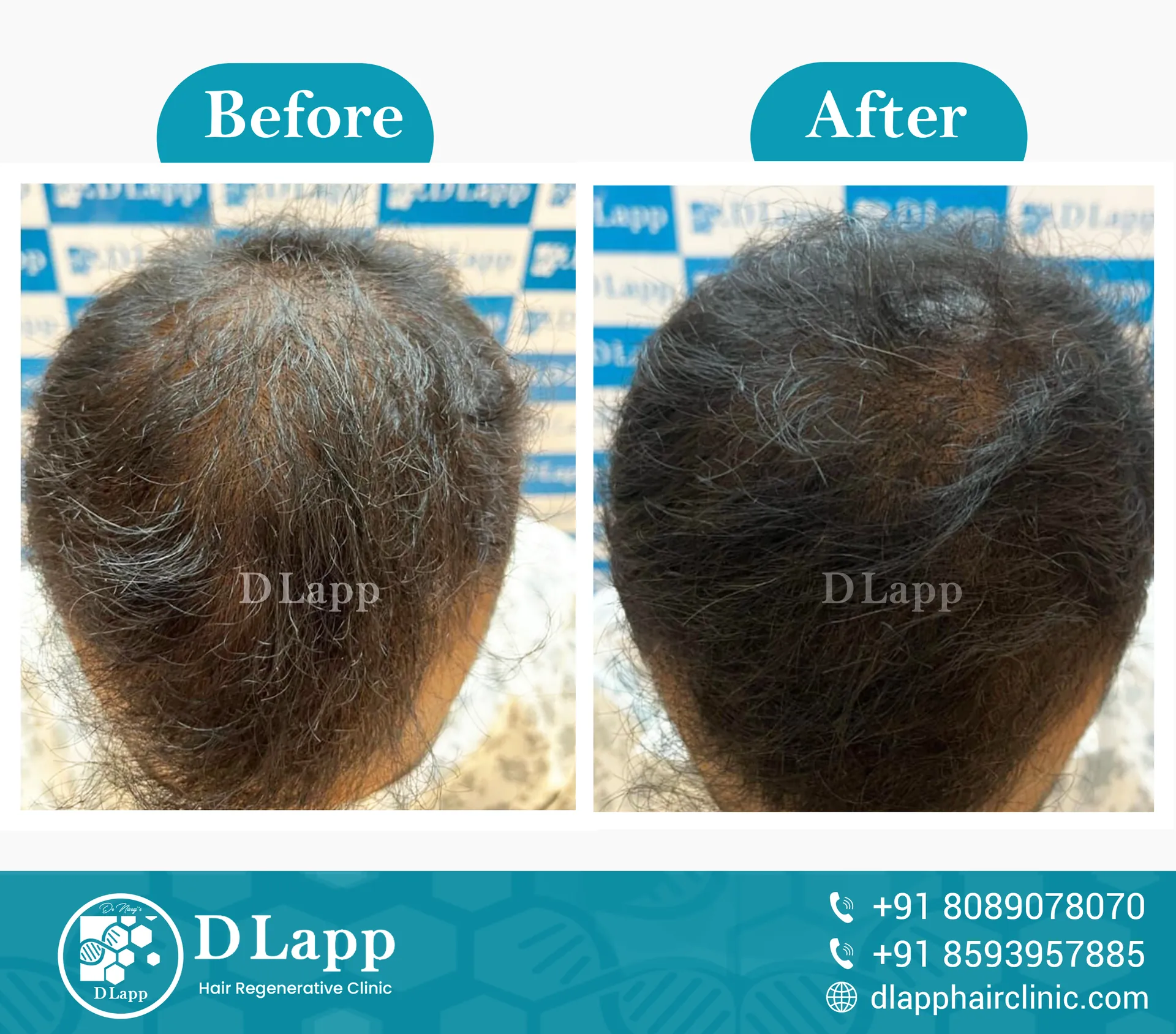 Before/After Medical Image