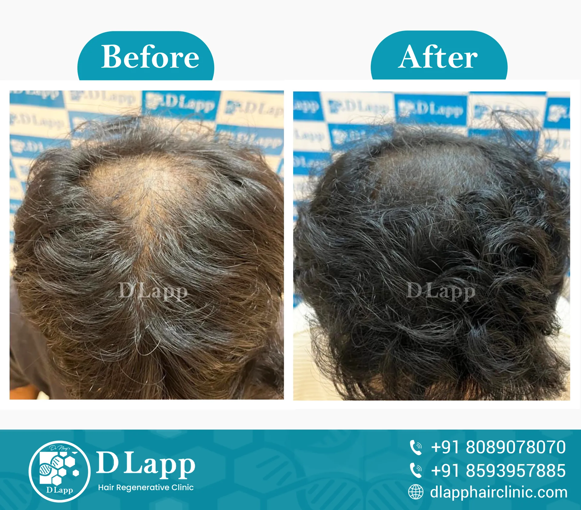Before/After Medical Image