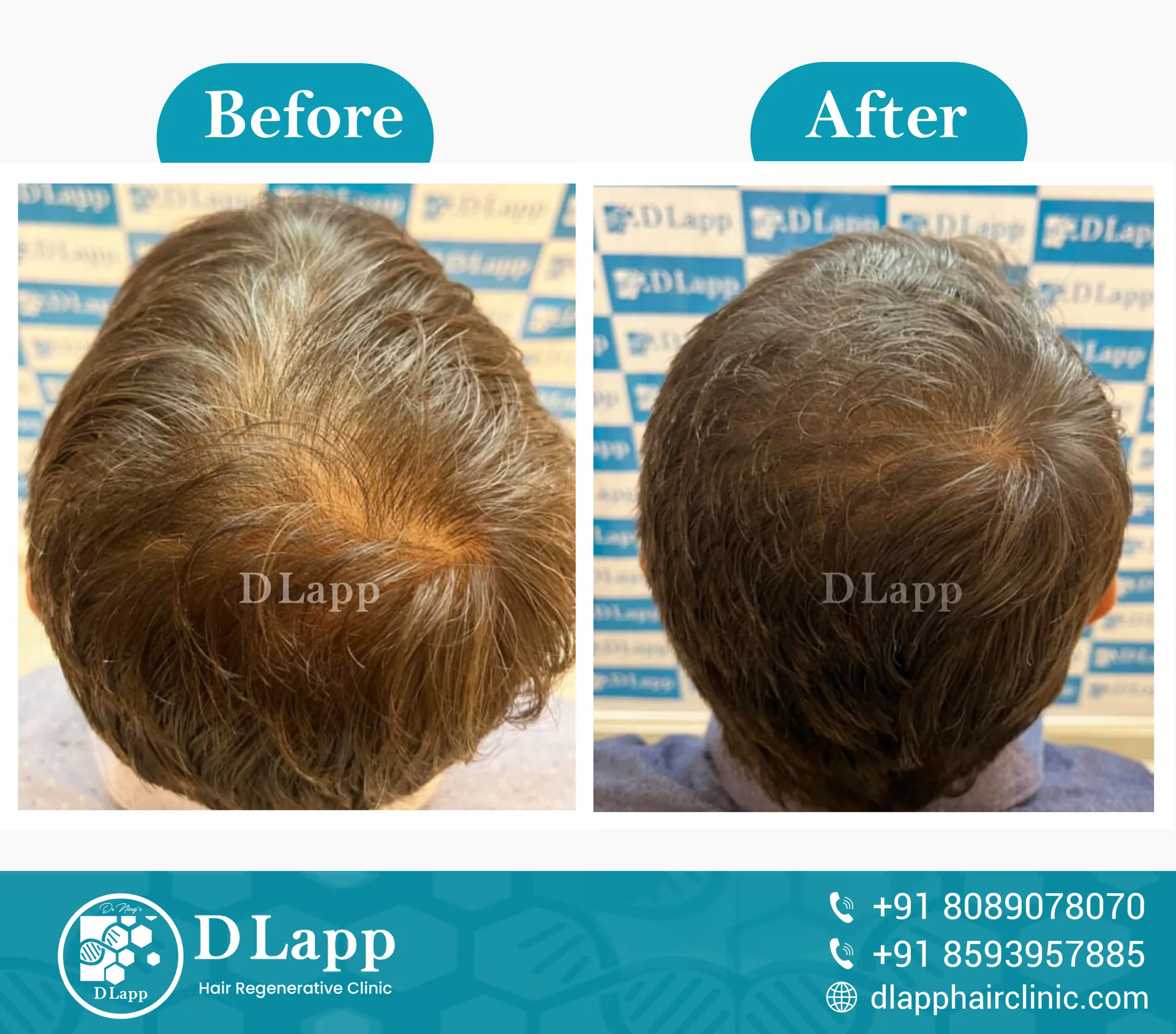 Before/After Medical Image