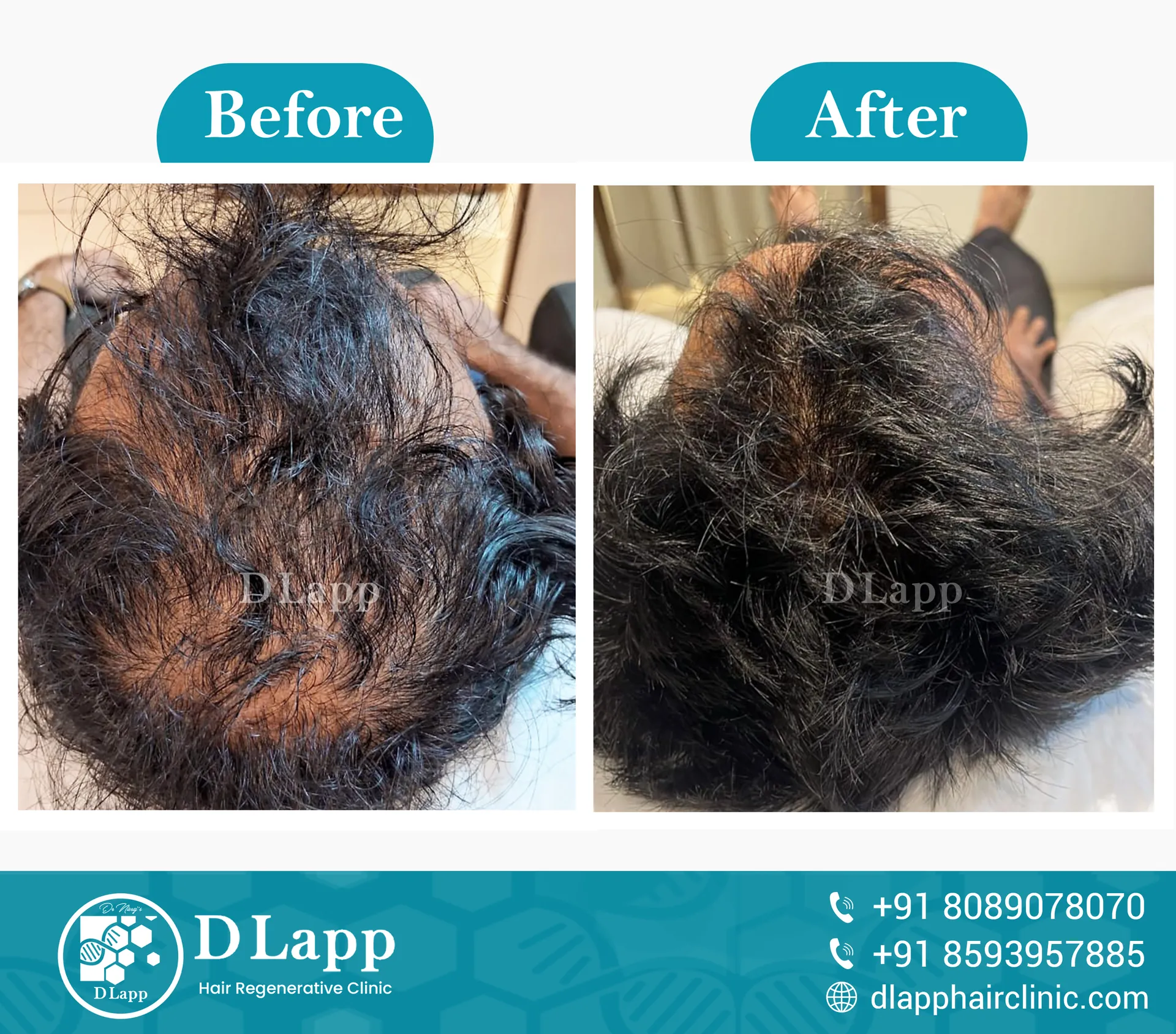 Before/After Medical Image