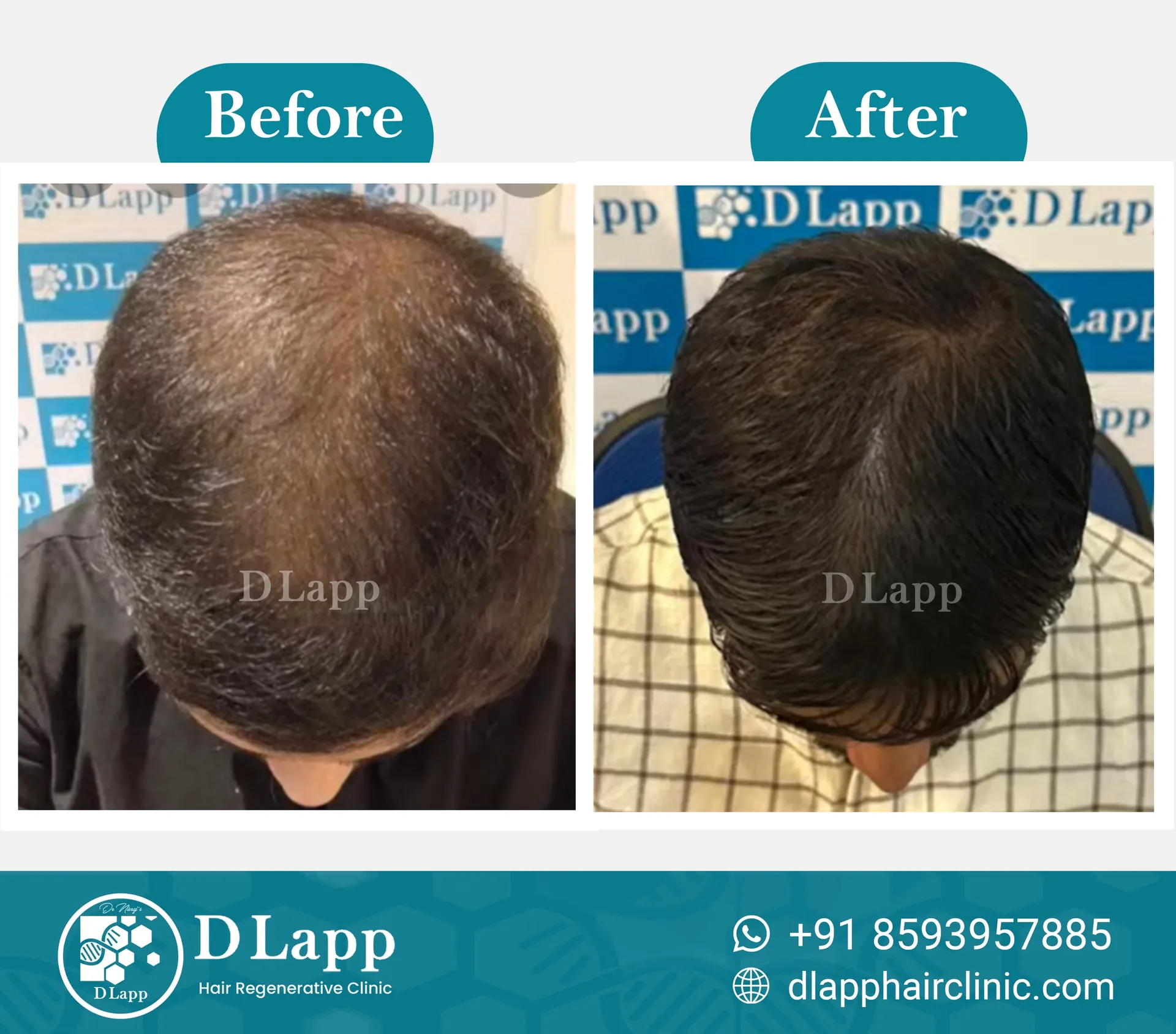 Before/After Medical Image
