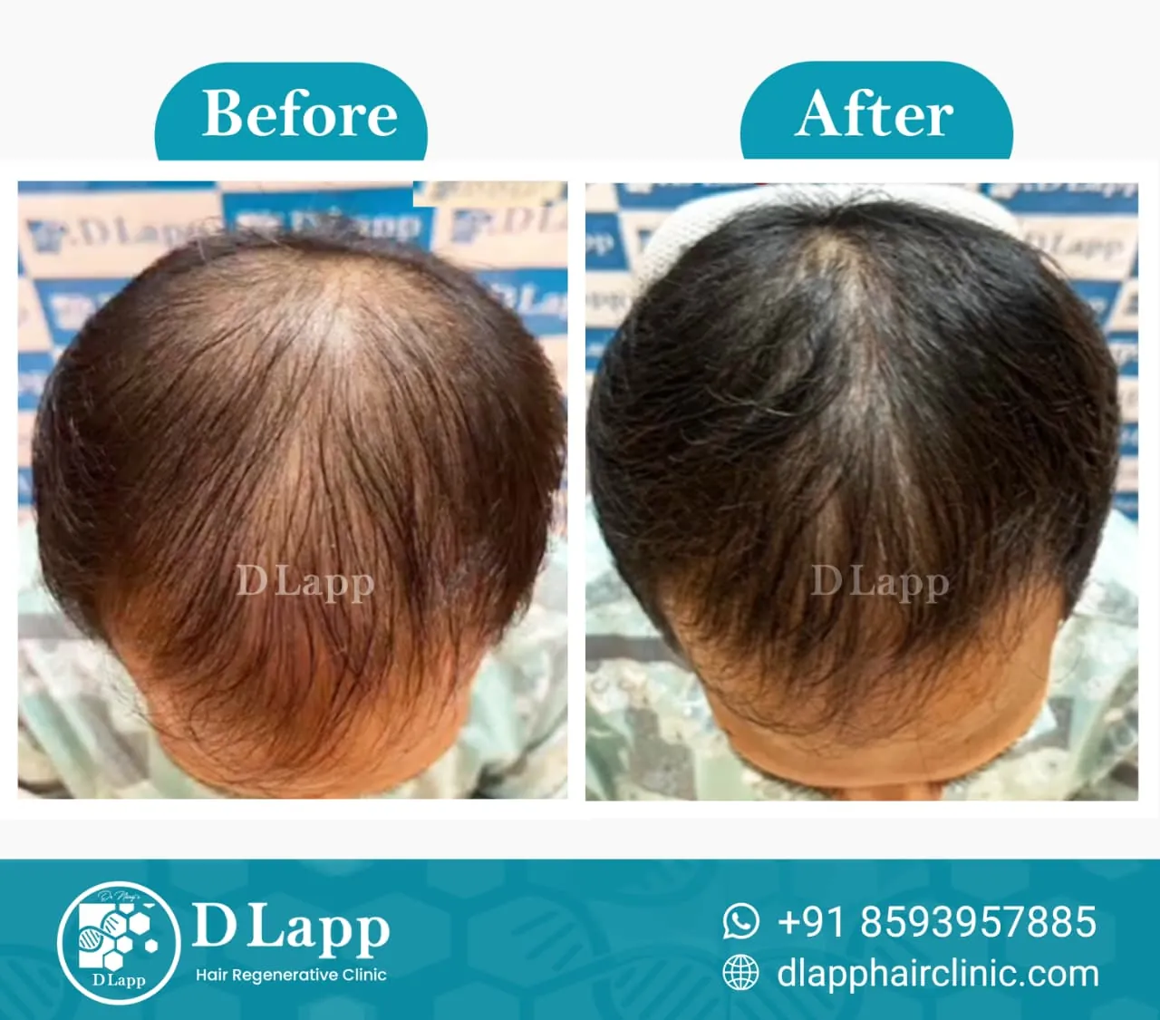 Before/After Medical Image