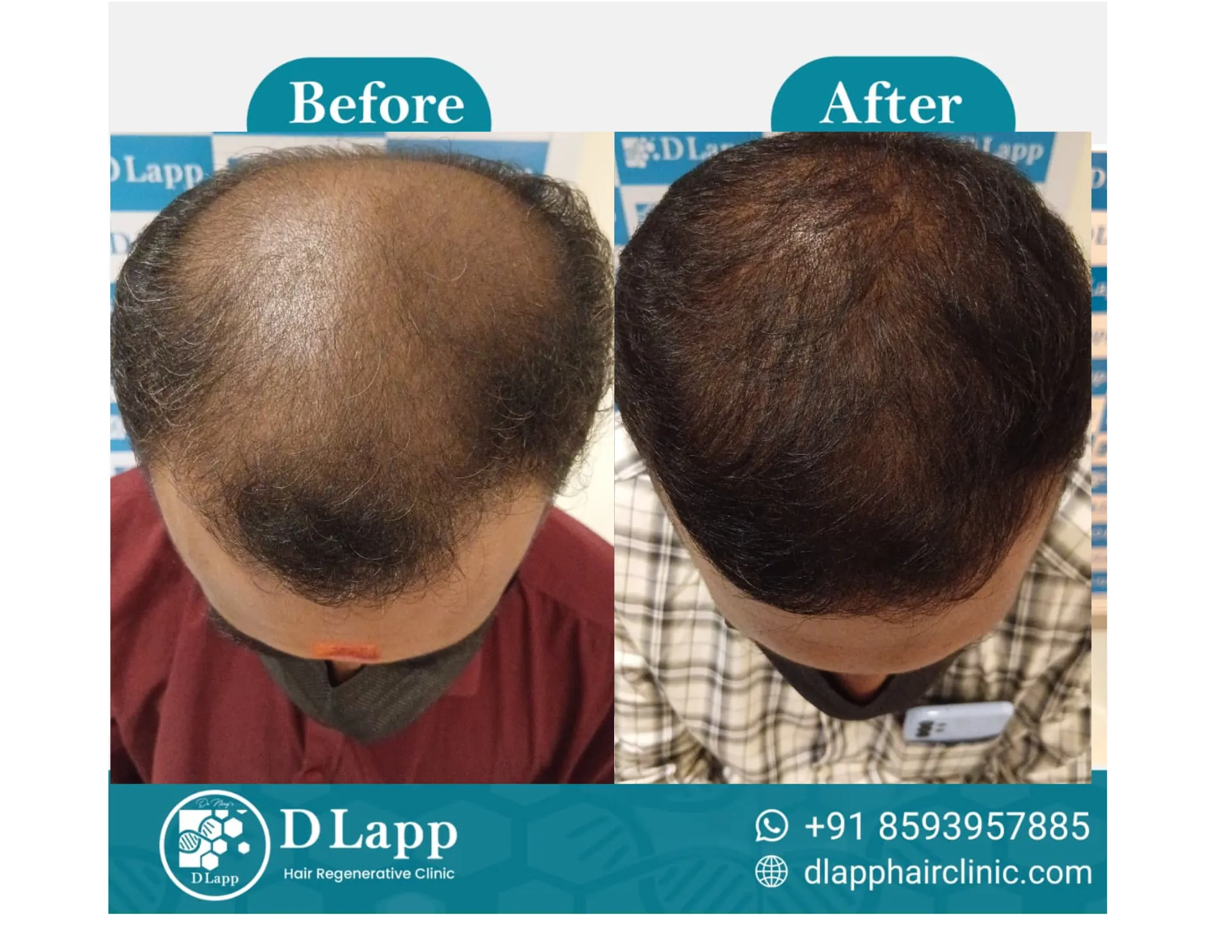 Before/After Medical Image