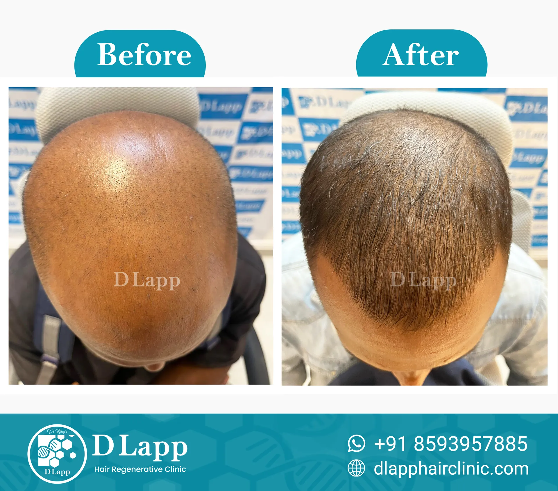 Before/After Medical Image