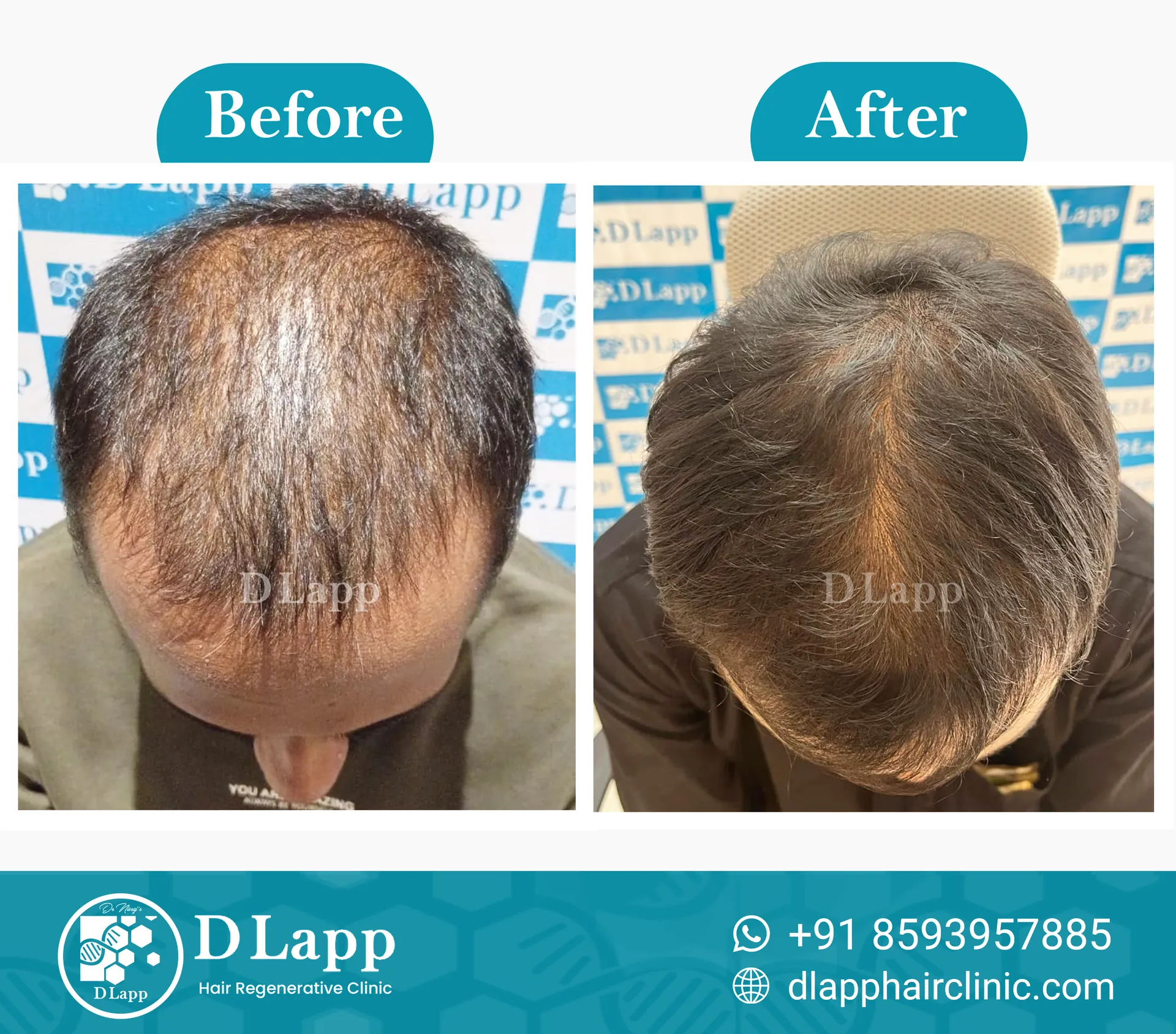 Before/After Medical Image