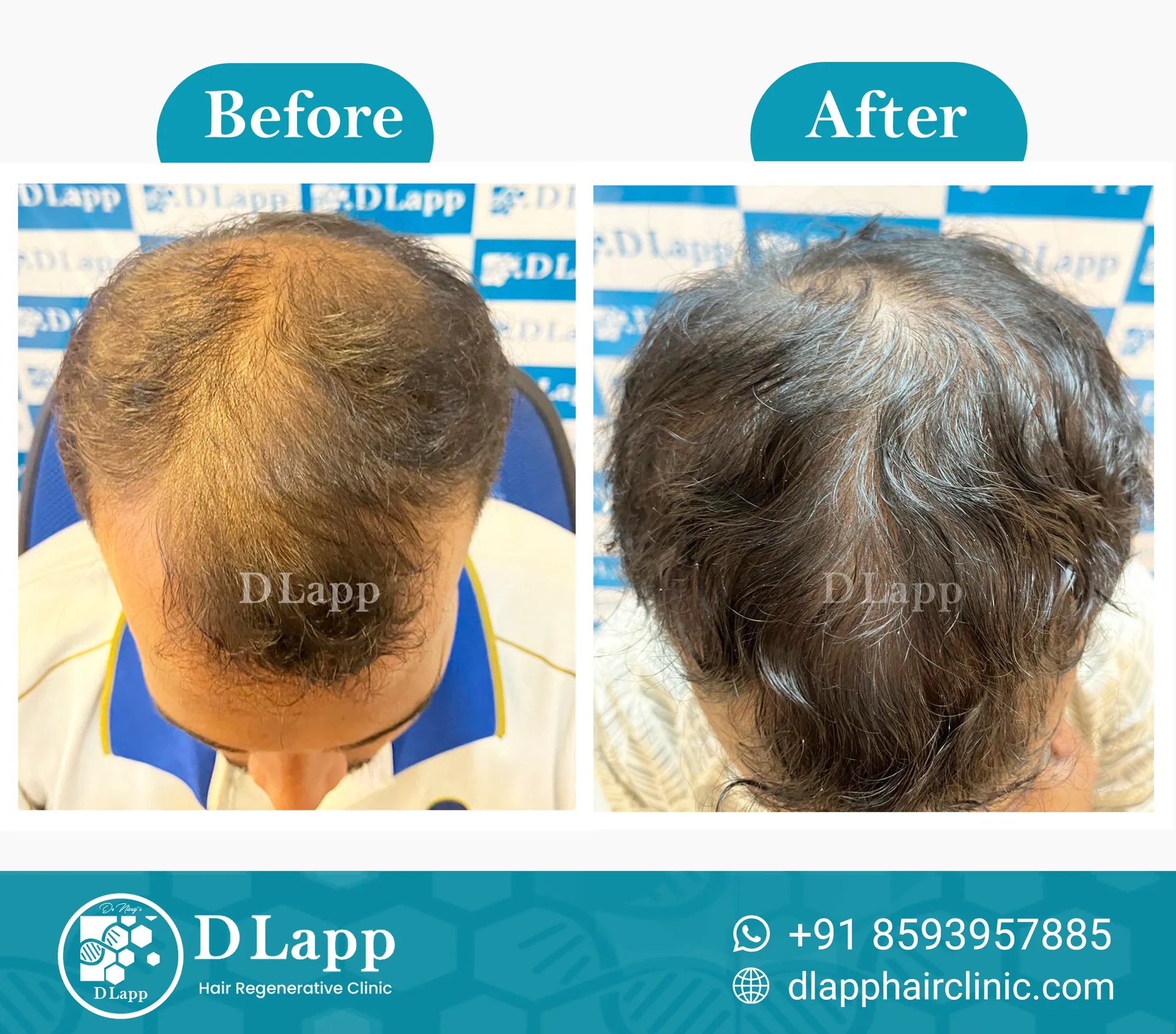 Before/After Medical Image