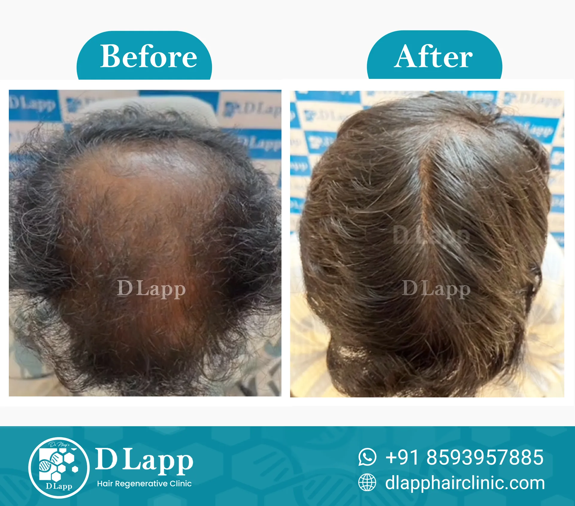 Before/After Medical Image