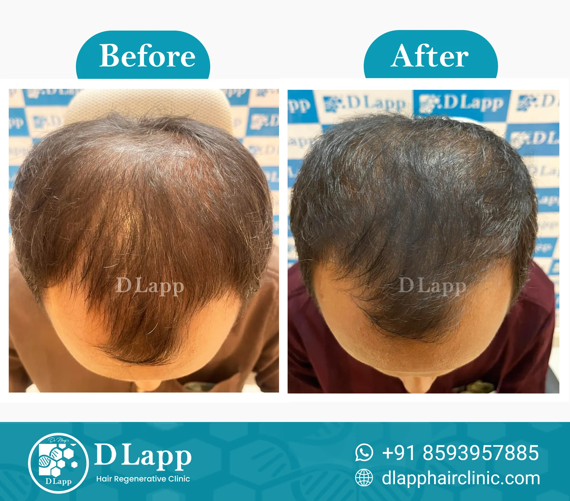 Before/After Medical Image