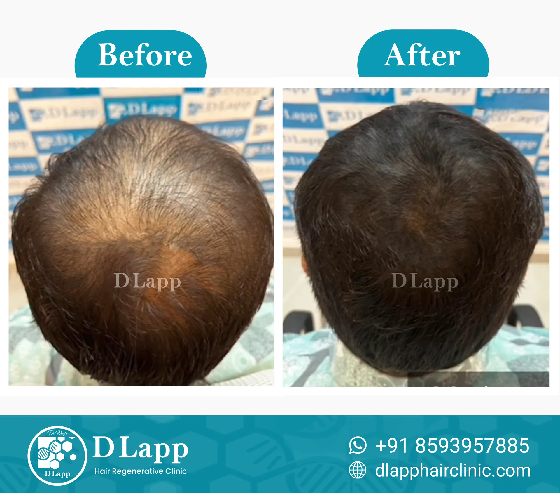 Before/After Medical Image