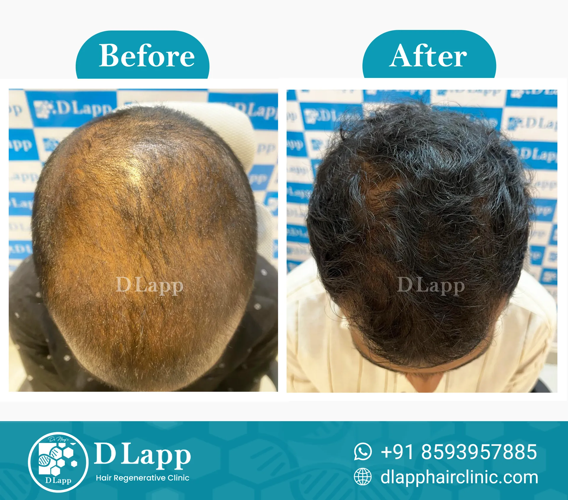 Before/After Medical Image