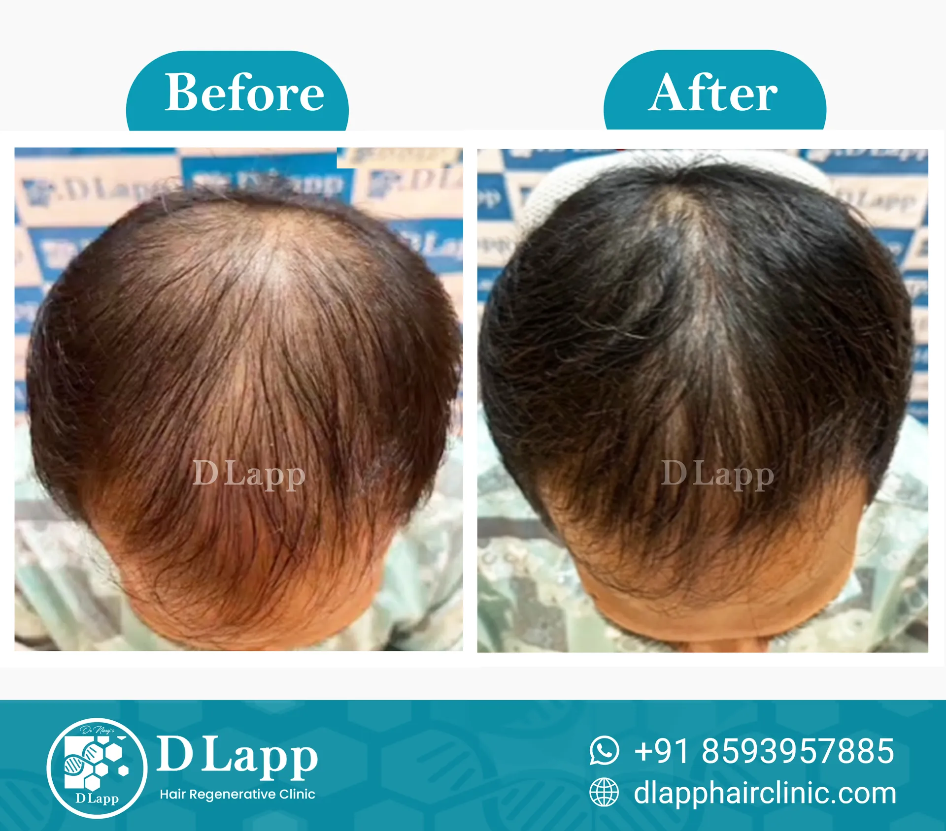 Before/After Medical Image