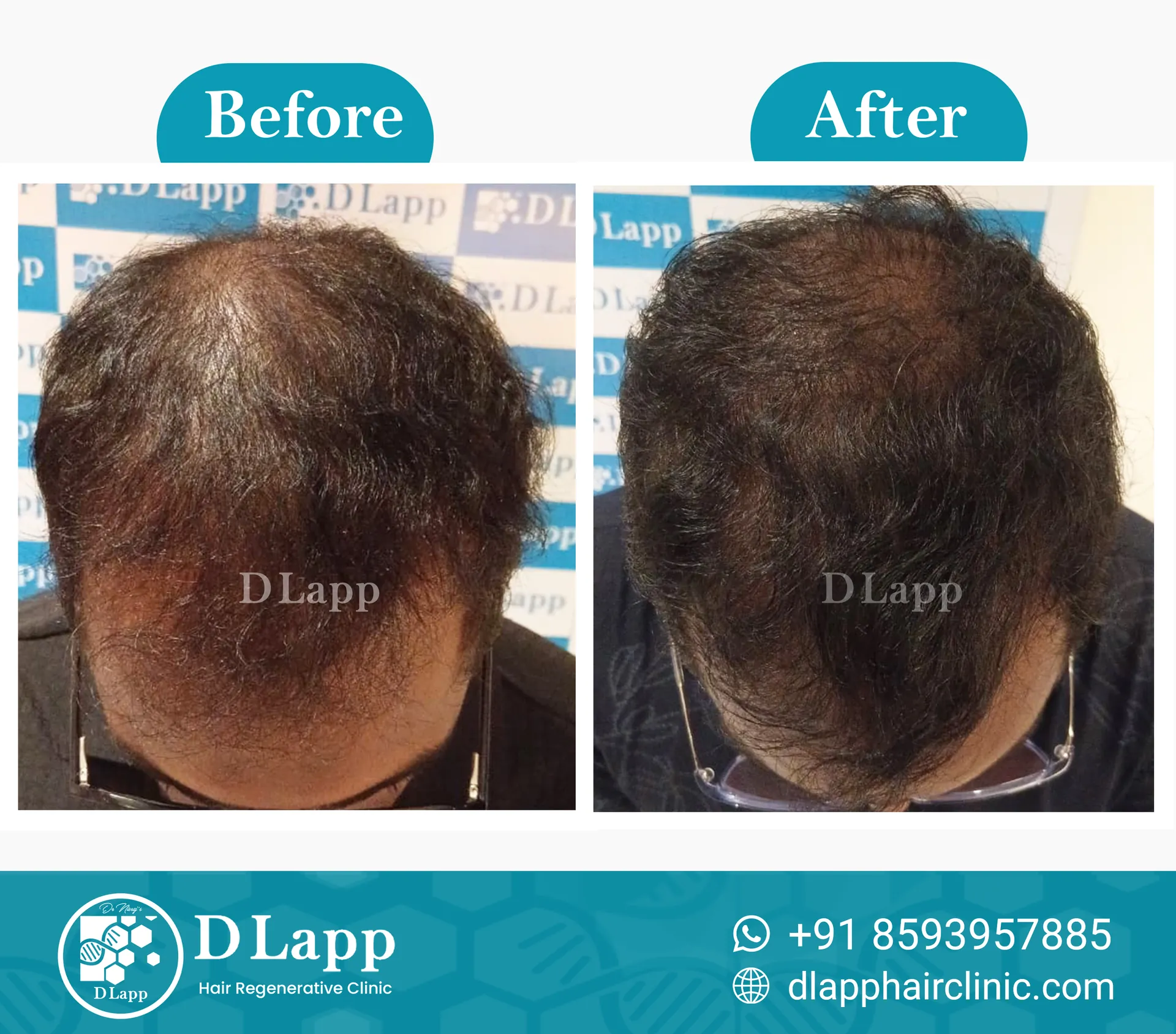 Before/After Medical Image