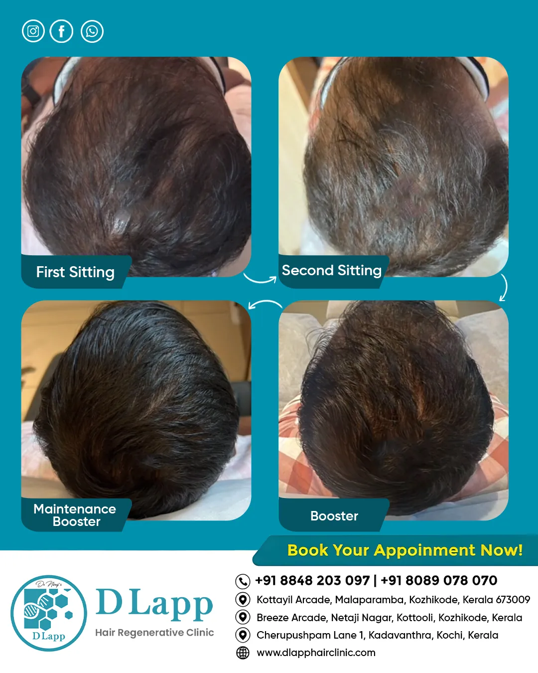Before/After Medical Image