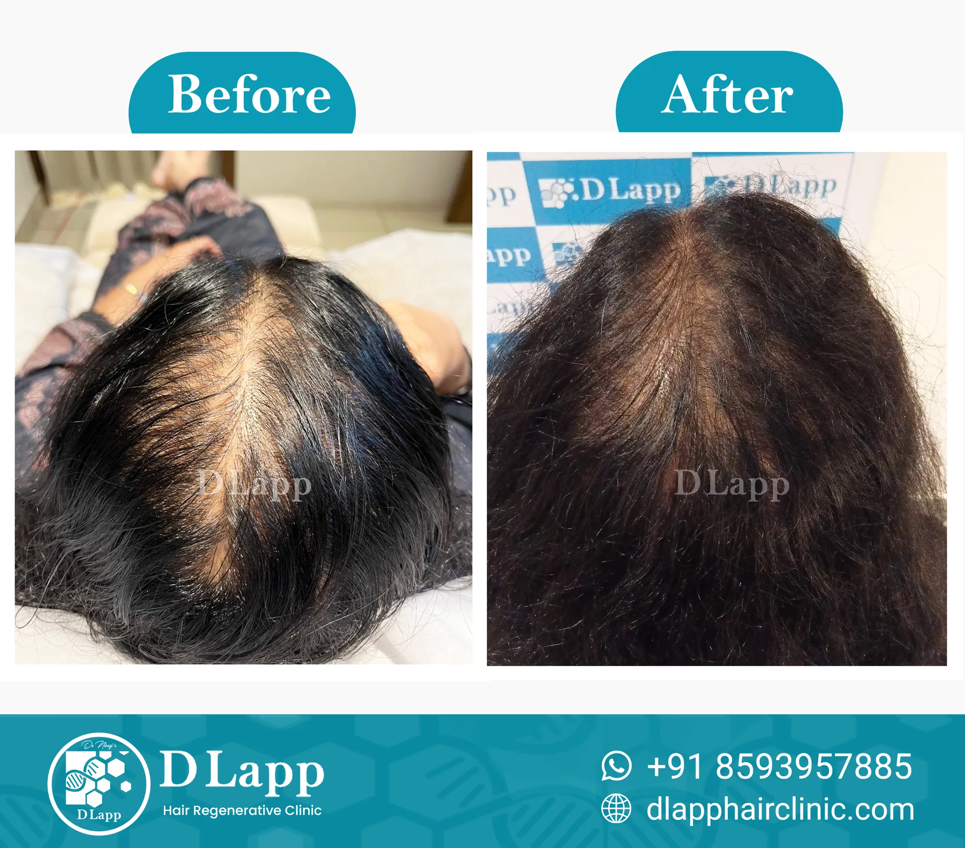 Before/After Medical Image