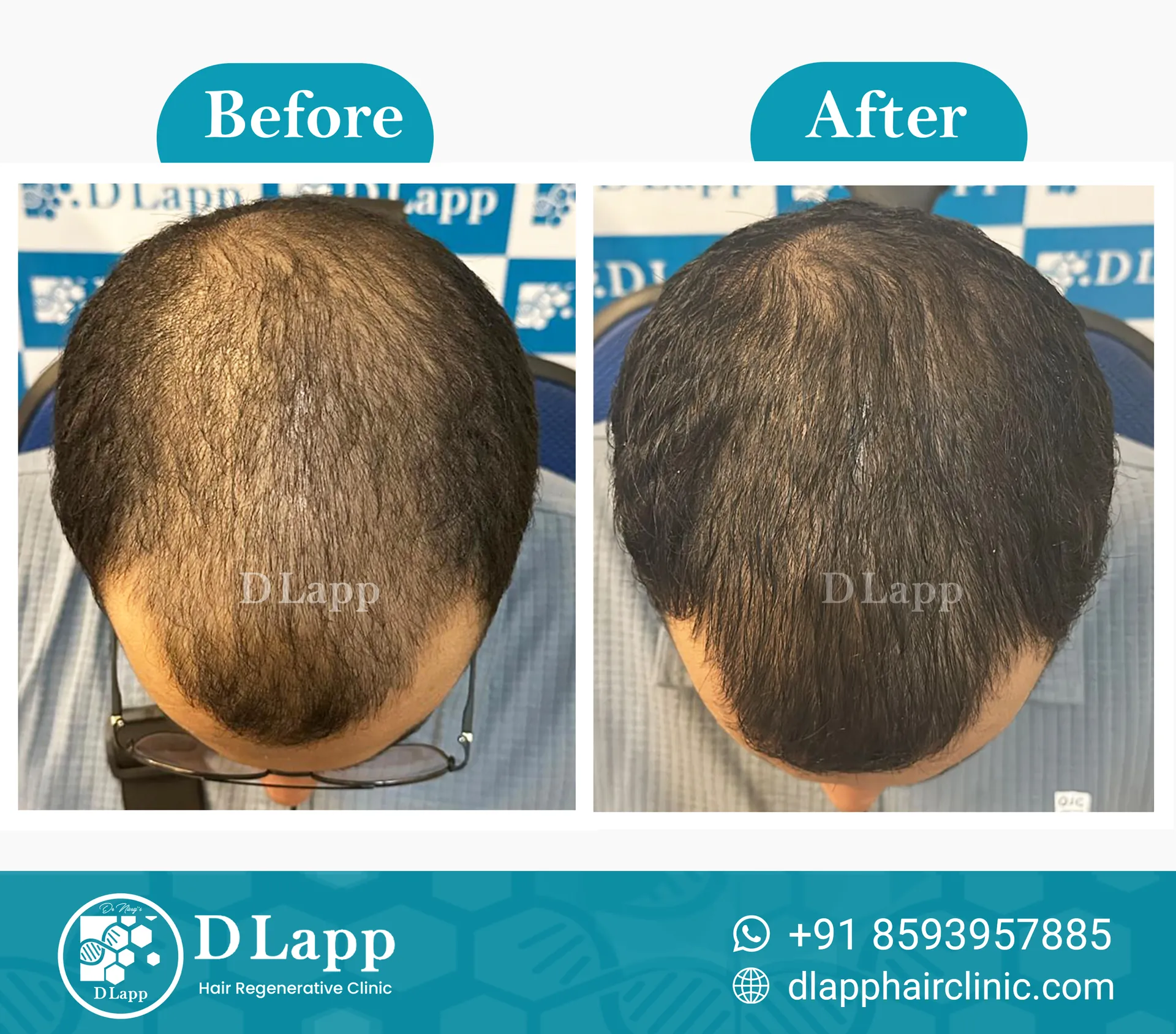 Before/After Medical Image