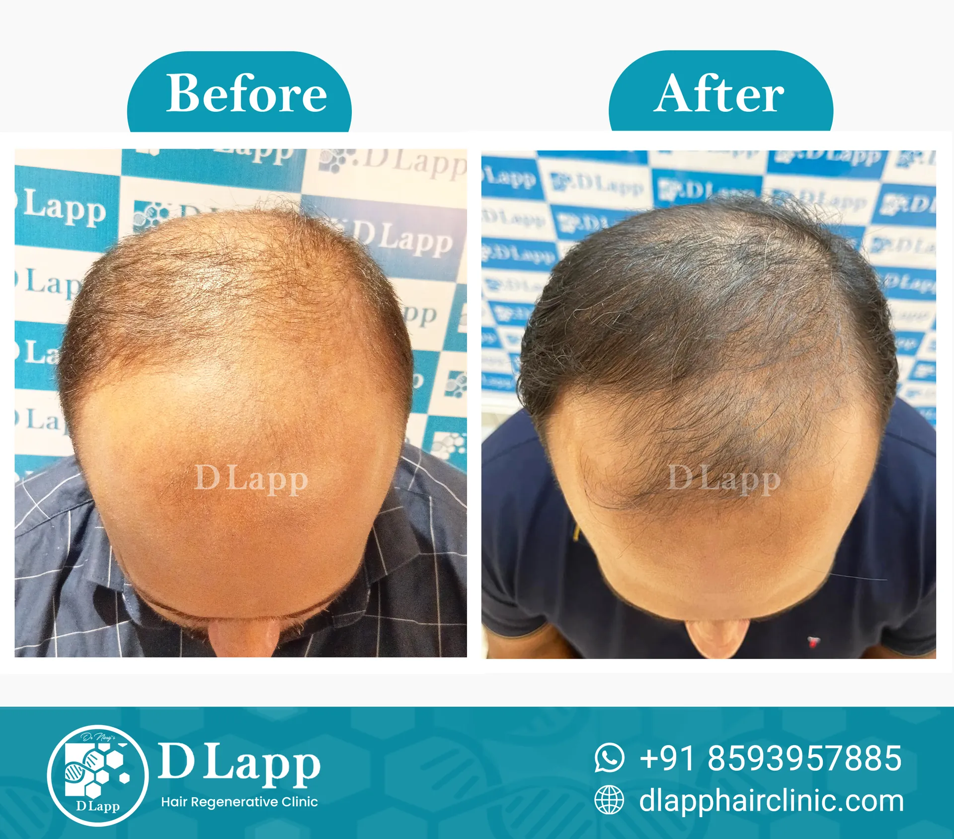 Before/After Medical Image