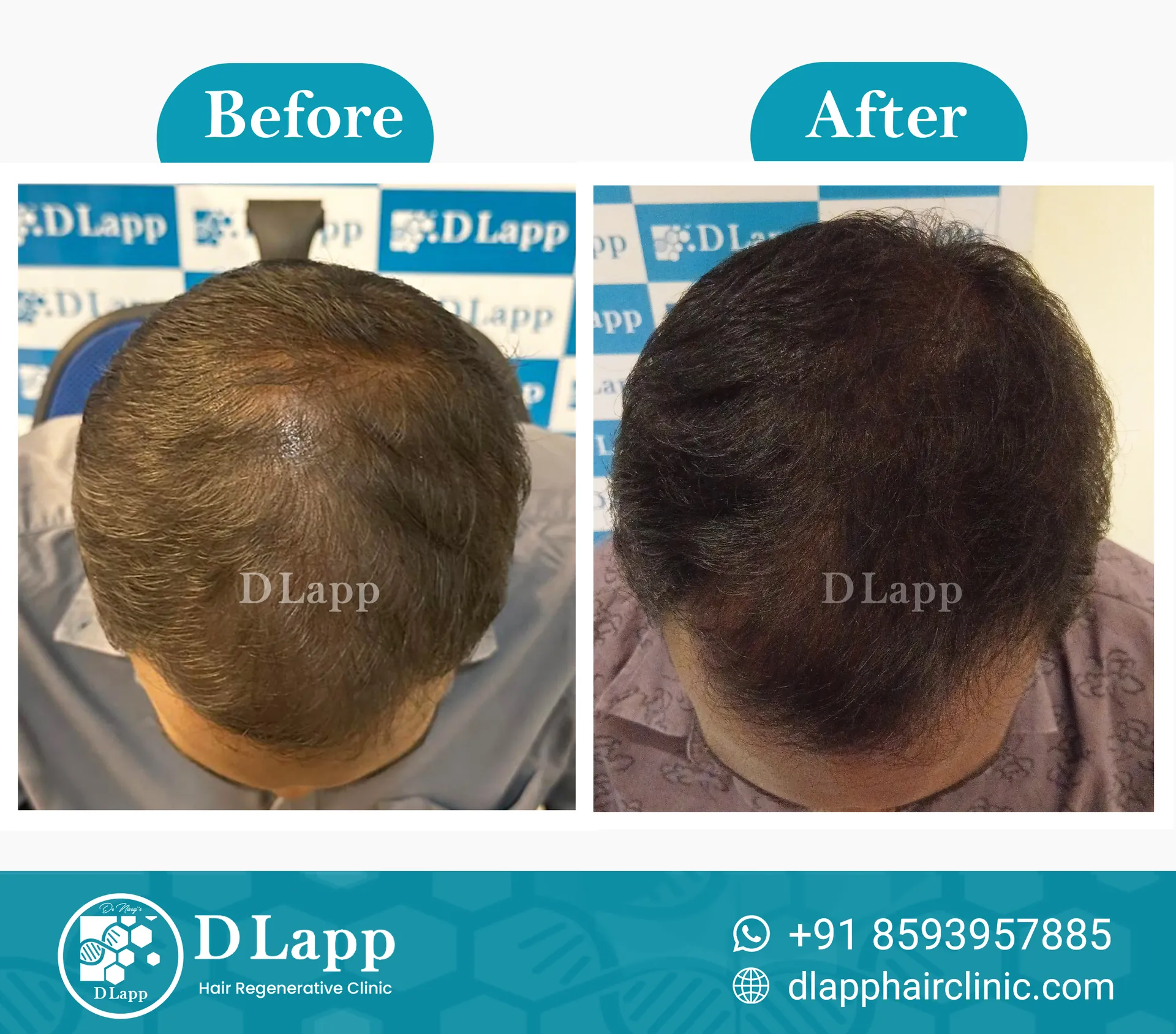 Before/After Medical Image
