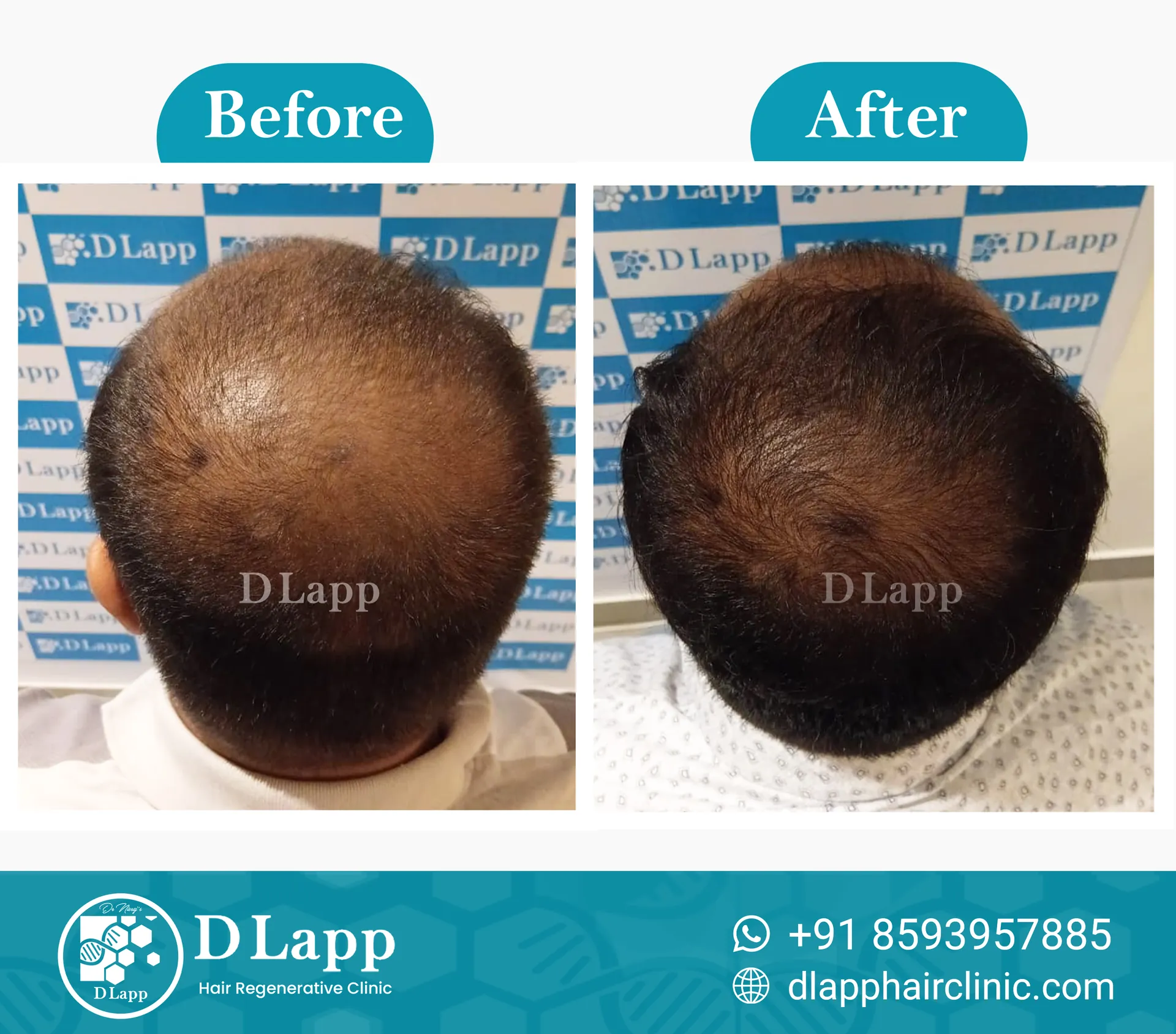 Before/After Medical Image