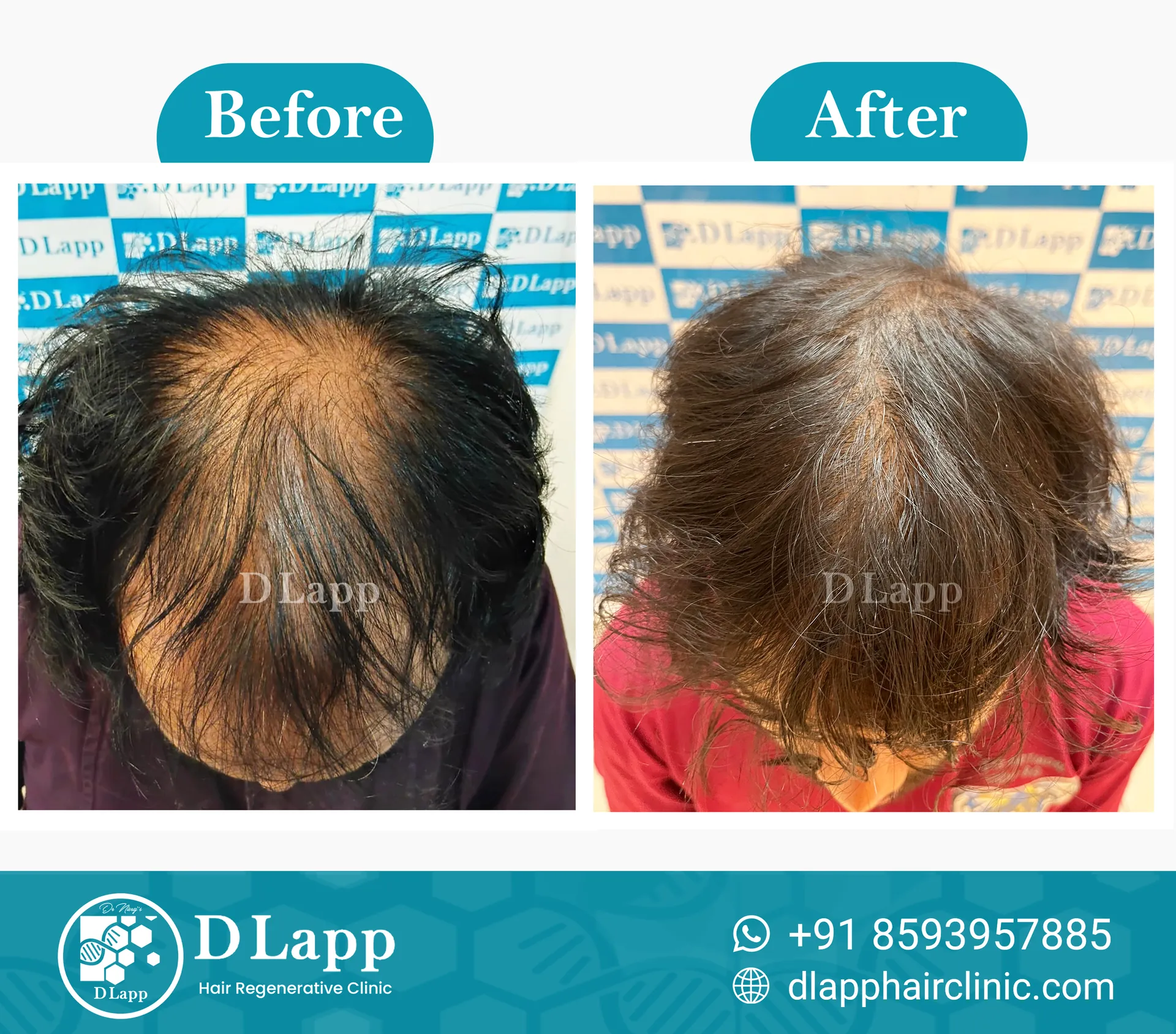 Before/After Medical Image